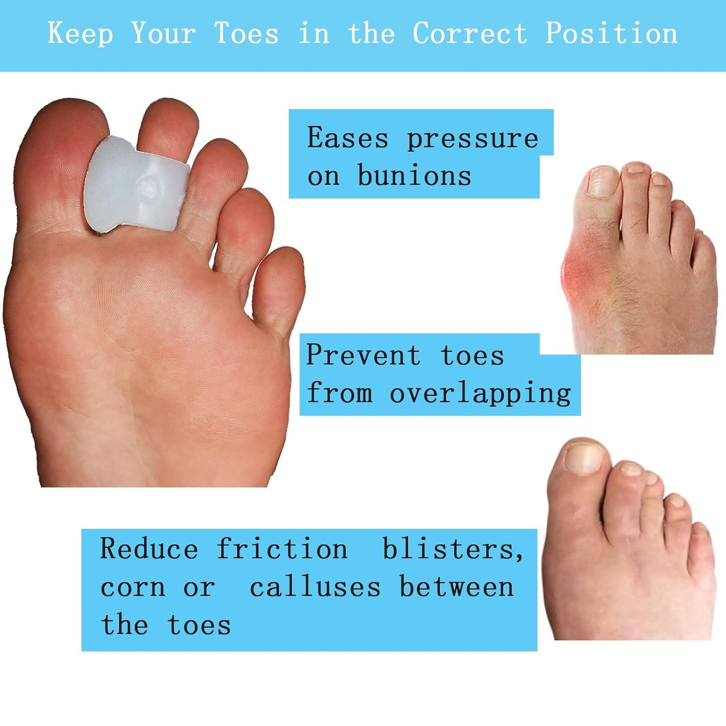 Pack of 12 Gel Toe Separator, (1/4" Thick) Big Toe Spacers, Single Loop Toe Spreader for Bunions, Overlapping Toe, Corrector and Spacer (White)