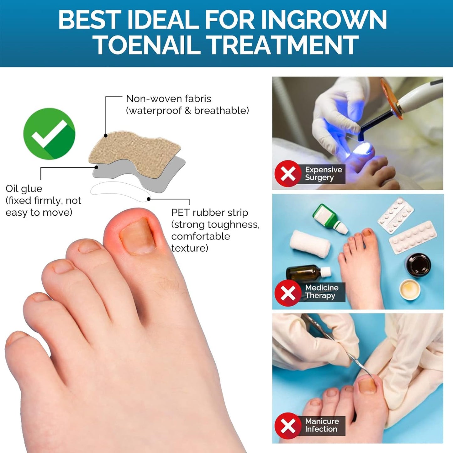 Ingrown Toenail Treatment, 50Pcs Ingrown Toenail Removal Kit with File and Lifter, Professional and Fast Acting