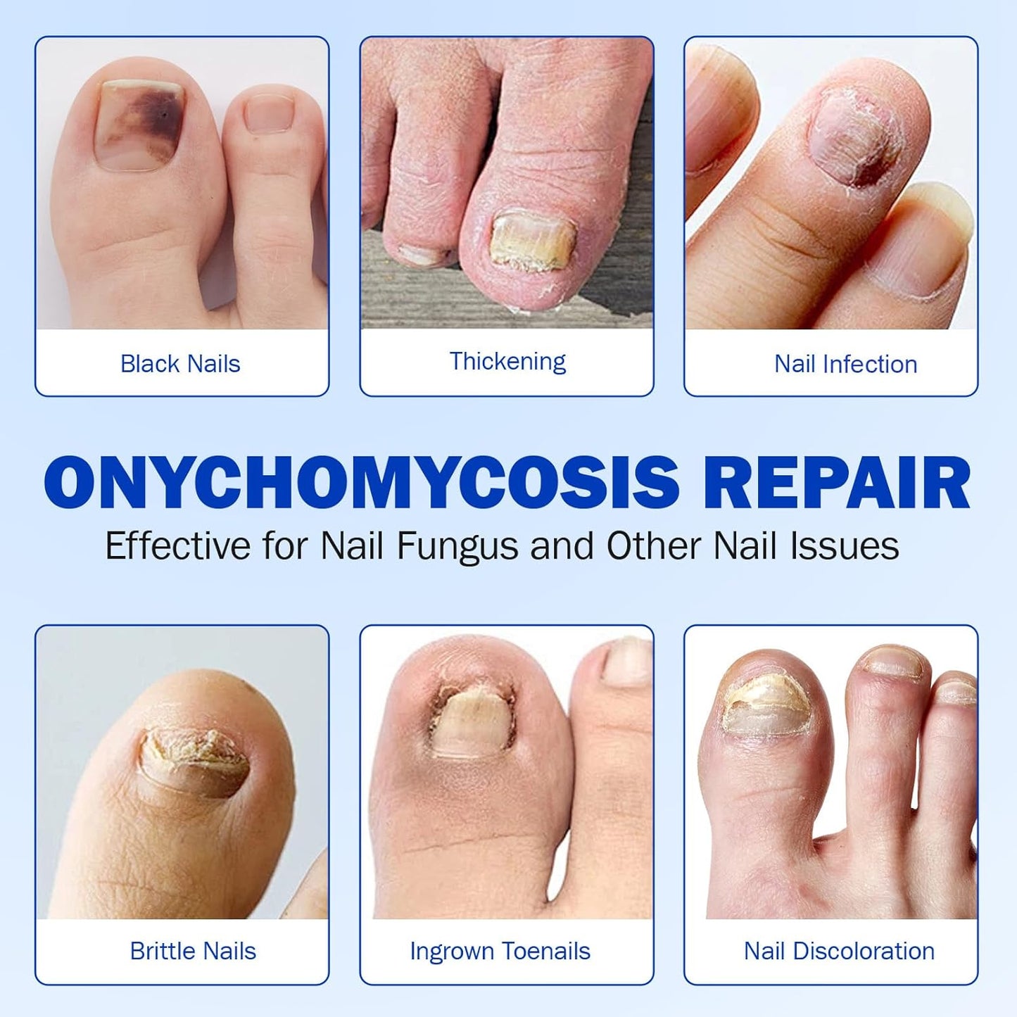 Nail Patches, 21 Pcs Toenail Treatment Extra Strength 8-Hour Overnight Nail Fast Acting Repair for Damaged & Discolored Nails Overnight Renewal Effortless Hydrogel Nail Care for Men and Women