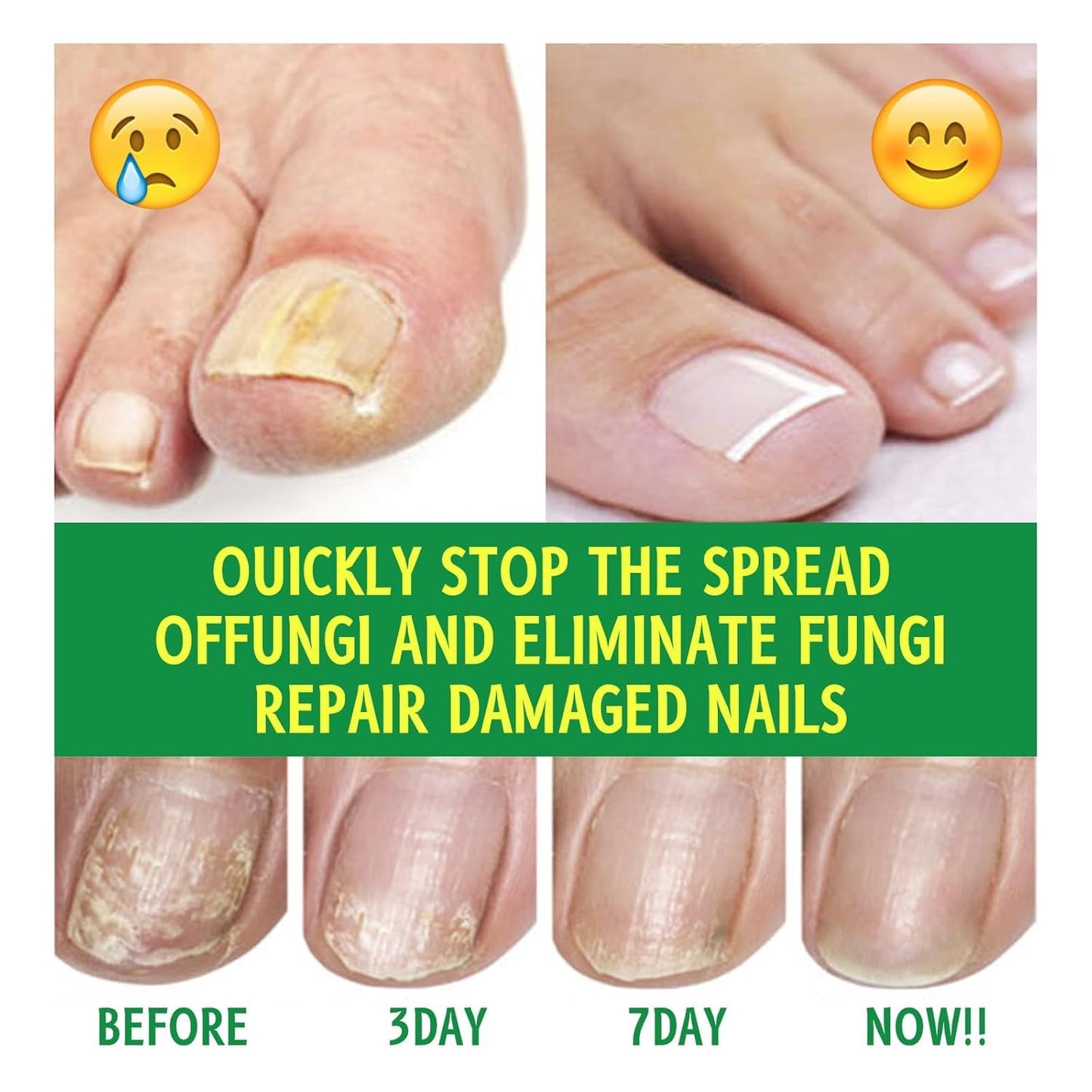 Ginger Nail Treatments, 7 Days Ginger Cuticle Care Oil for Nails for Strengthen nails & Promote Nail Growth, Natural Plant Formula（2PCS)
