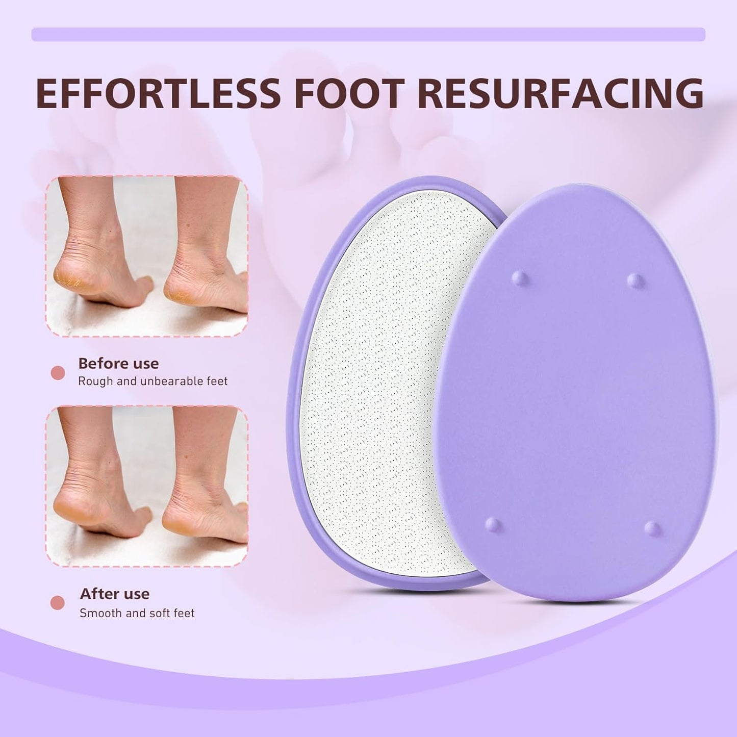 BALUCA Glass Foot File Callus Remover for Feet - Nano Glass Foot Scraper Scrubber Dead Skin Removal for Cracked Heels,Professional Pedicure Tool for Home, Salon, and Travel (Purple)