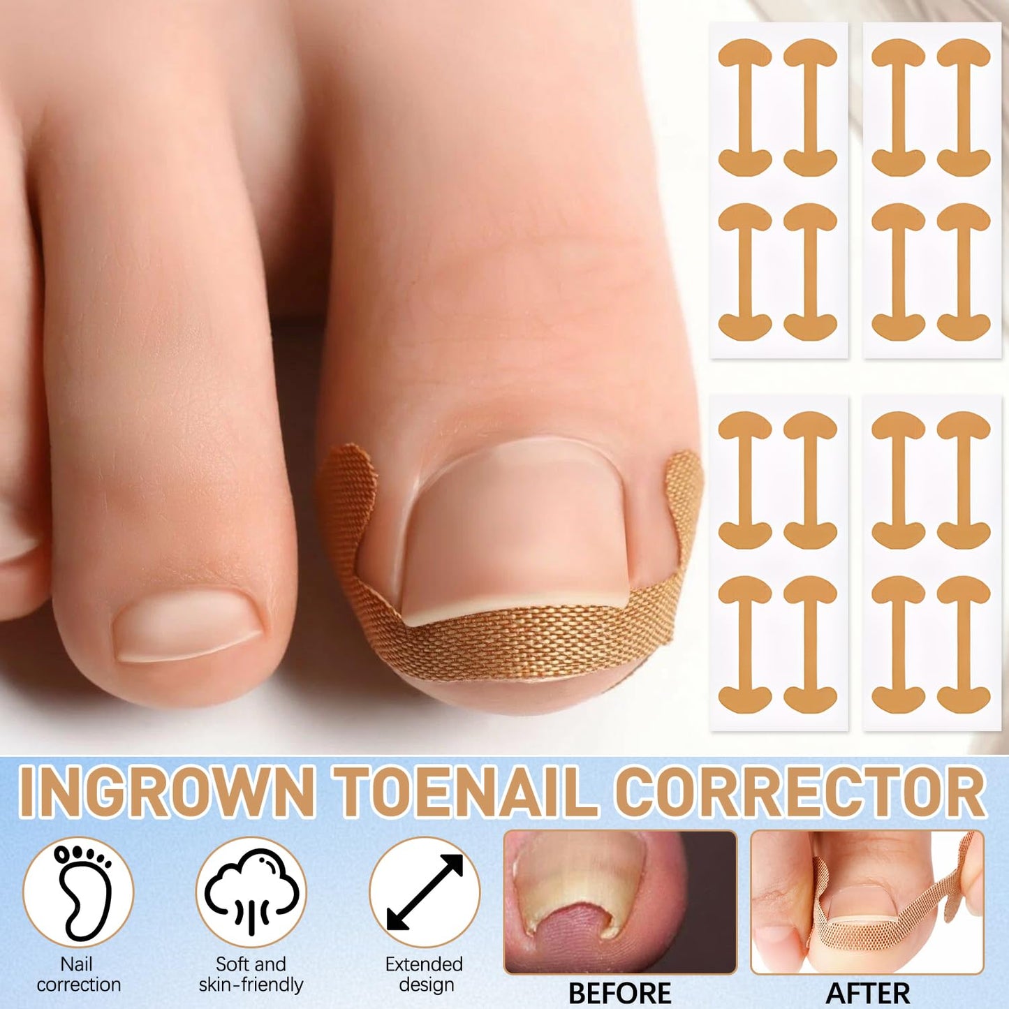 Ingrown Toenail Treatment,50Pcs No Glue Breathable Toenail Corrector Patch with File and Lifter,Professional Ingrown Toenail Corrector,Ingrown Toenail Tools for Quick Relief