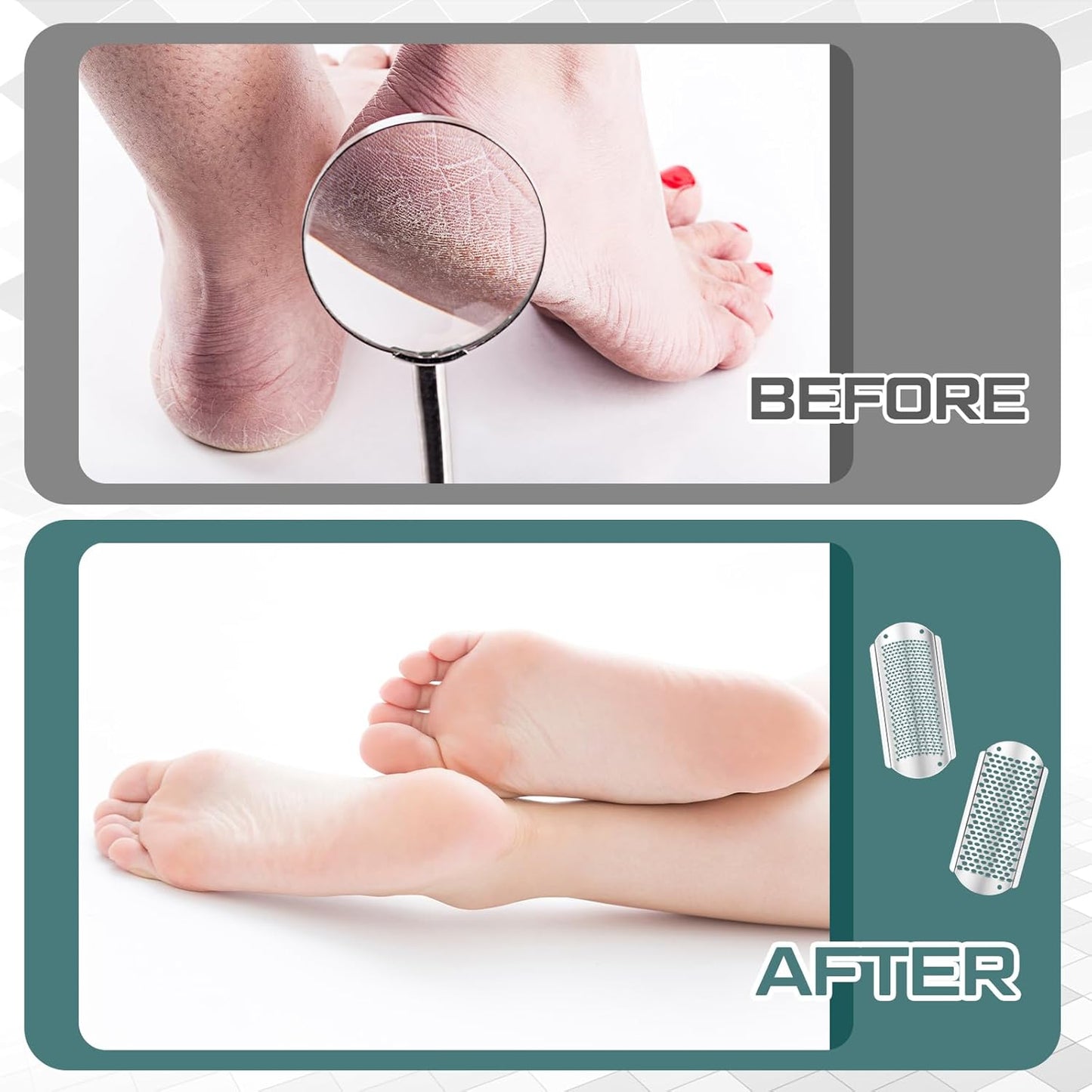 Moxweyeni 8 Pcs Foot File Callus Remover Replacement Blades Metal File Callus Remover Shaver Blades Hard Skin Remove Stainless Steel 2 Designs Big/fine Hole for Detachable Foot Scrubber