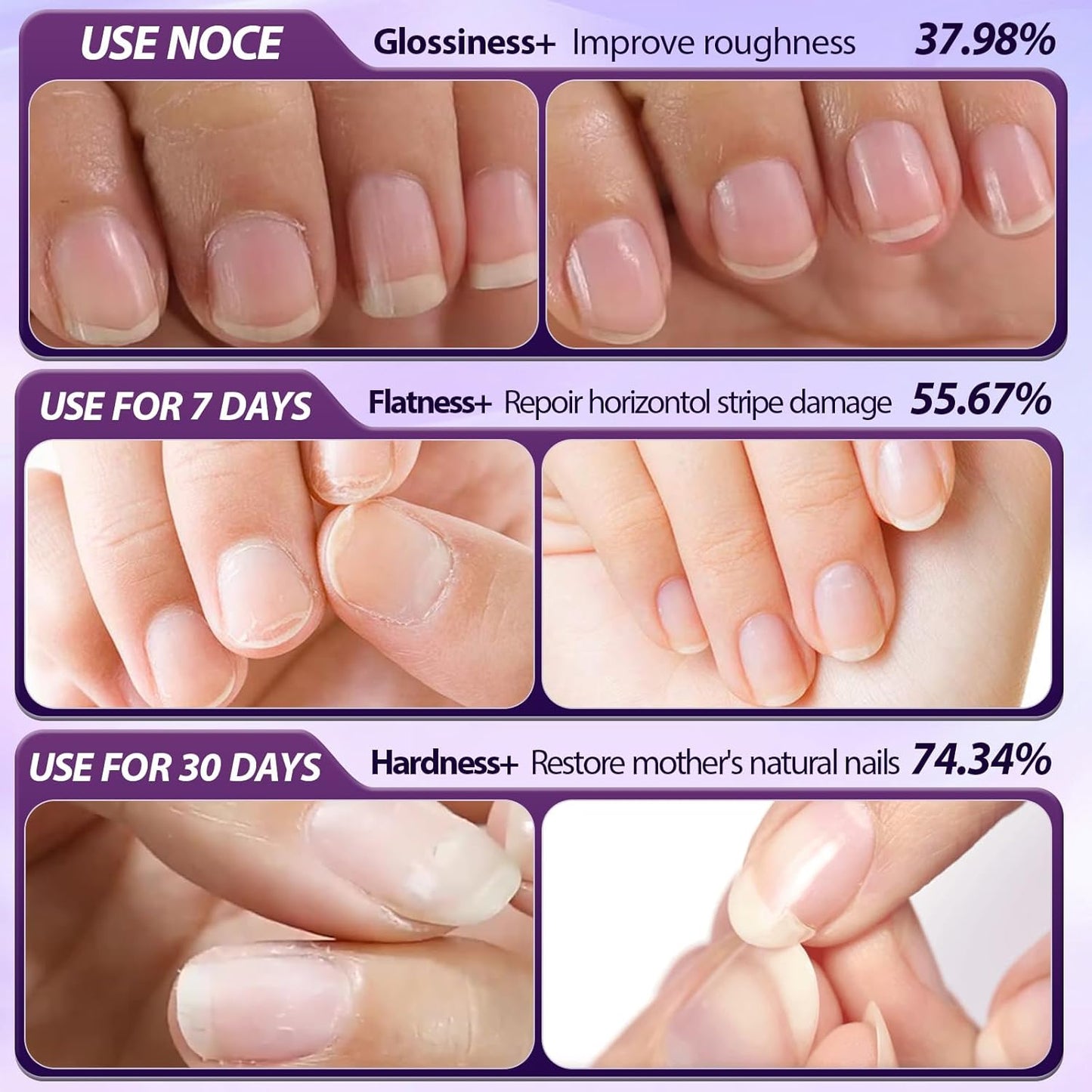 3-in-1 Cuticle Oil Pen,Cuticle Pusher Nail Oil Pen with Ceramic Tip,Dry & Damaged Nails,Nail Cuticle Remover Pen,for Moisturize Strengthen Nails(3PCS)