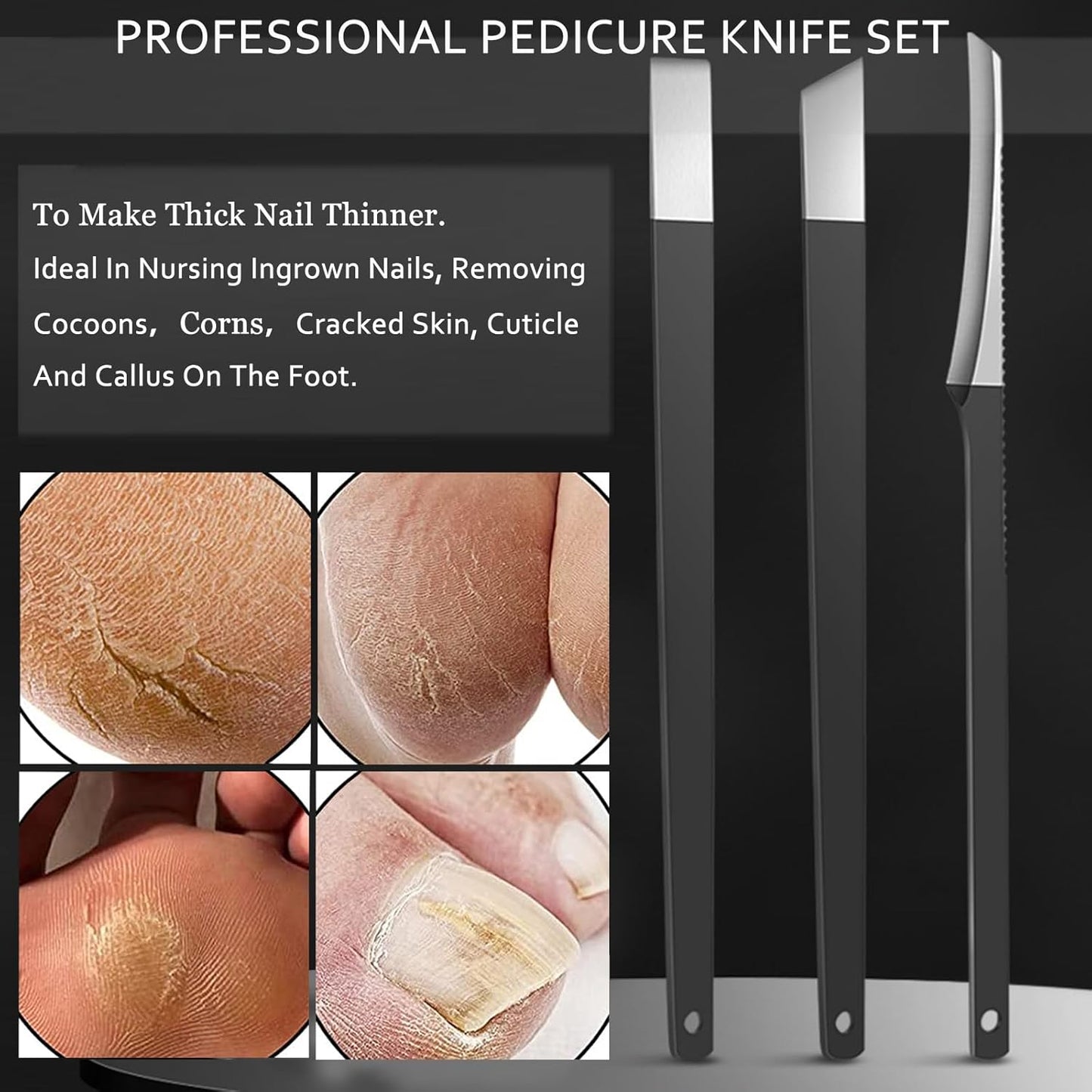 Ingrown Toenail Clipper Nail Cutter Pedicure Knife Thick Nail Clipper Senior Callus Remover Tools Men Women