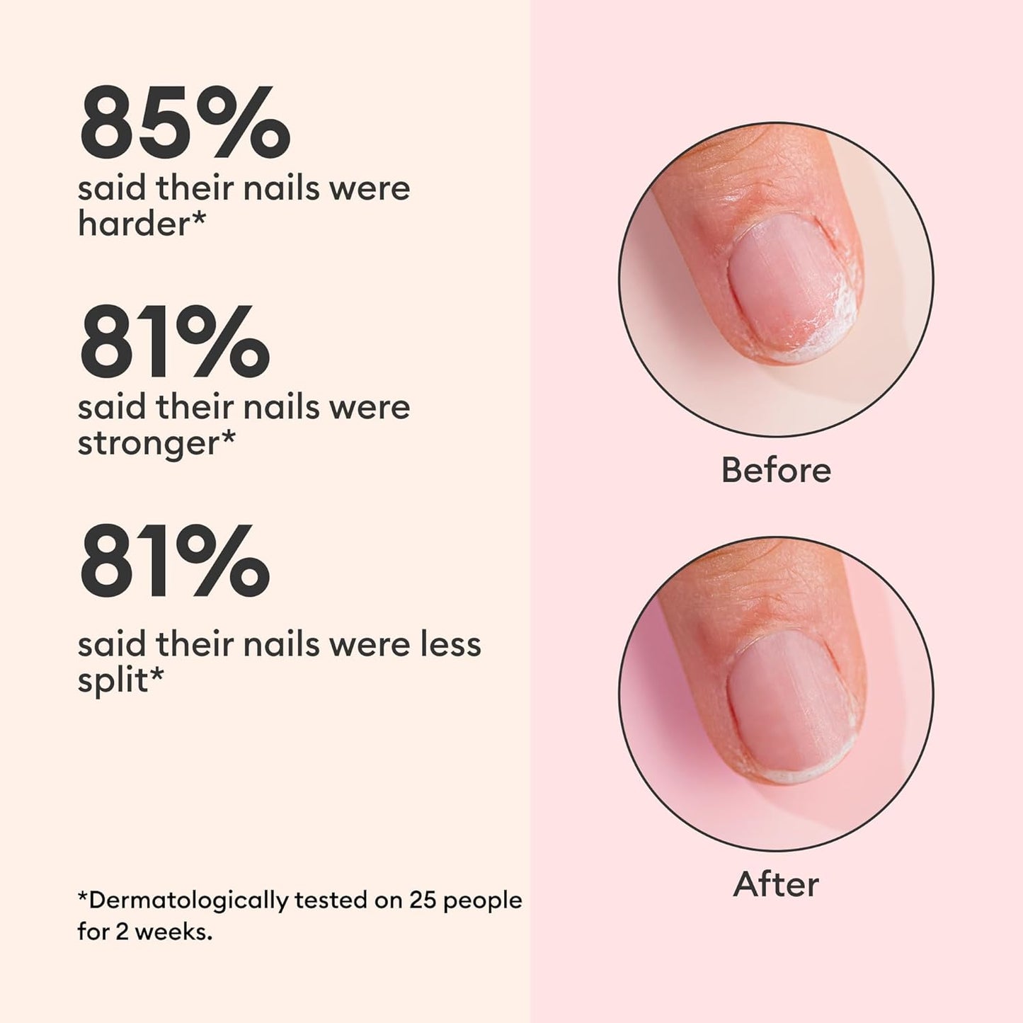 Manucurist Keratin Booster – Nail Strengthener for Damaged Nails – Nail Care with Plant-Based Keratin, AHAs, PHAs, MSM, Silicon, and Vitamin B8 – 97.5% Natural-Origin Ingredients