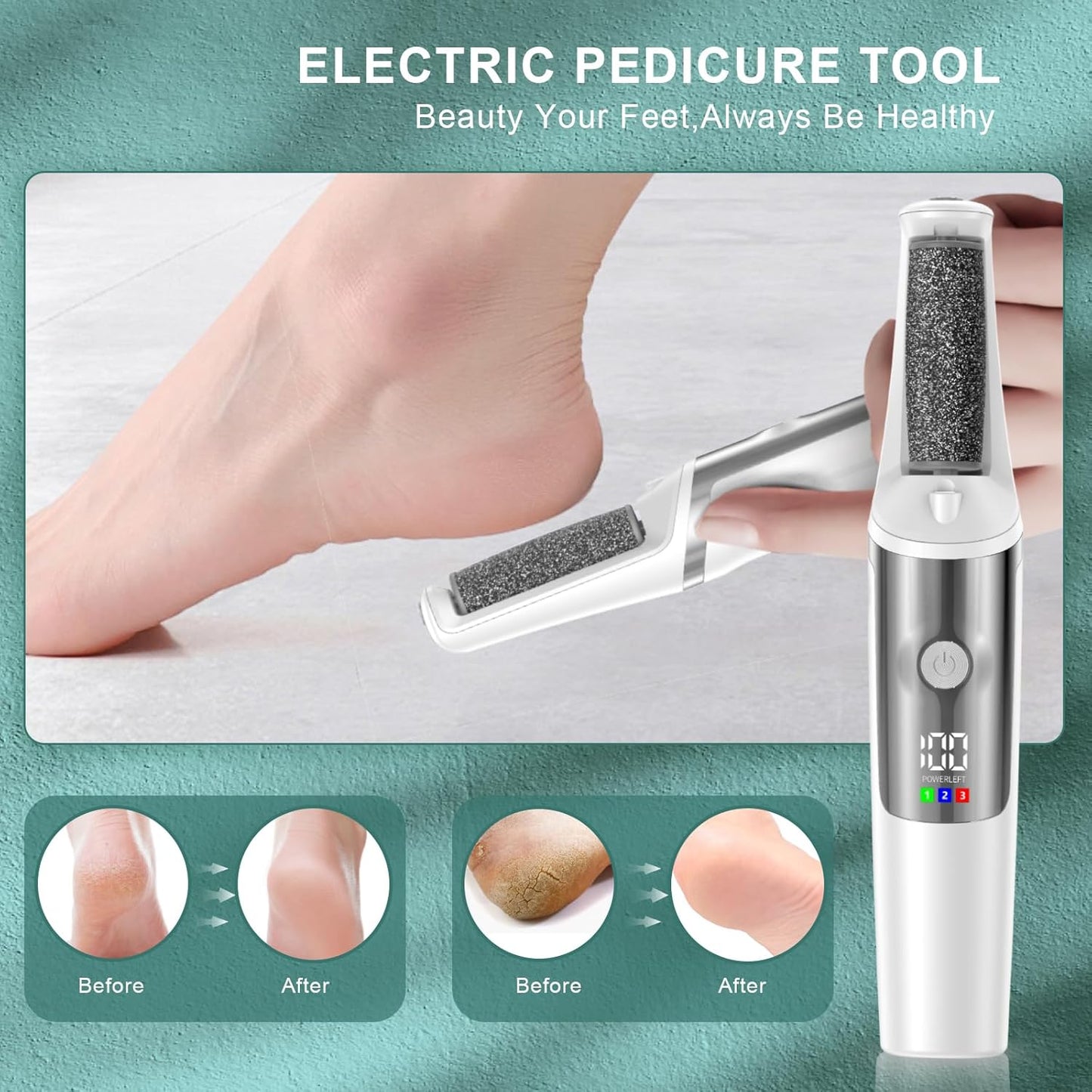 Electric Foot Callus Remover, Rechargeable Electronic Foot File Foot Scrubber Pedicure Kits, Professional Pedicure Tools Smooth Pedicure Wand, Foot Care for Dead Skin Ideal Gift, 3 Rollers,3 Speeds
