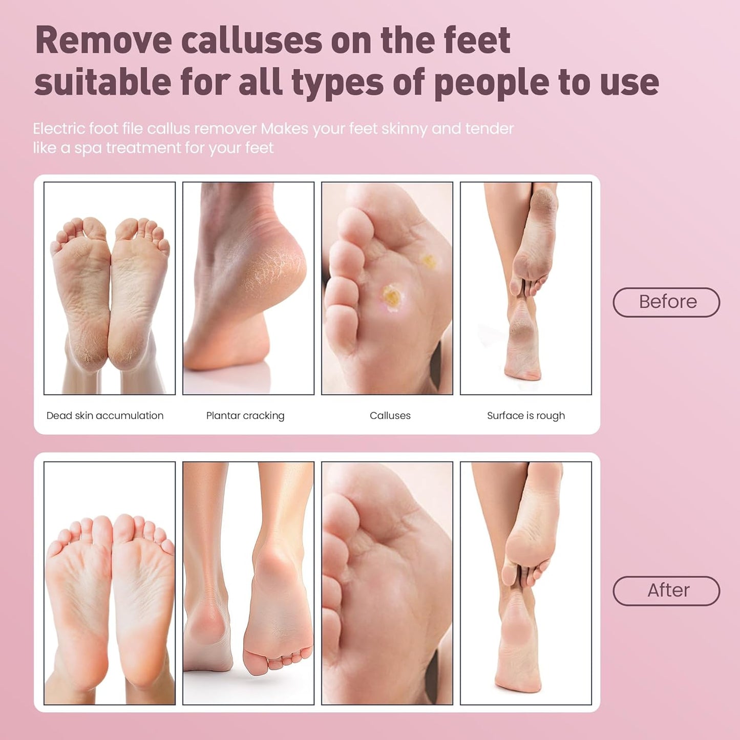 Electric Foot Callus Remover,2 in1 Rechargeable Callus Remover for Feet,9-Speed Cordless Electric Foot File Nail Grinder,Foot Scrubber Pedicure Tools for Dead Skin Dry Cracked Feet(Pink Fold)