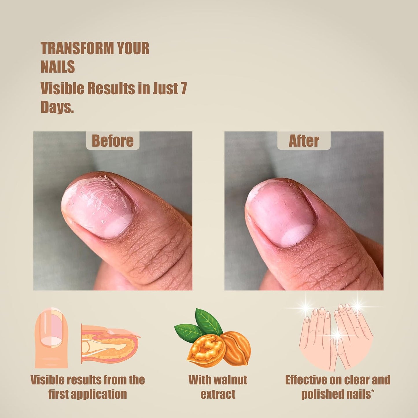 Lazonail® Nail and Cuticle Repair & Strengthening Gel | Results in 7 Days | Hydrates, Hardens and Adds Shine | Effective with or without Nail Polish | 3 ml