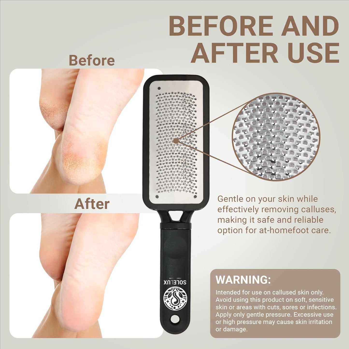 Foot Grater Callus Remover - Foot File Callus Remover for Feet Care - Surgical Grade Stainless Foot Scrubber Dead Skin Remover for Wet and Dry Foot - Foot Rasp Callus Remover Professional