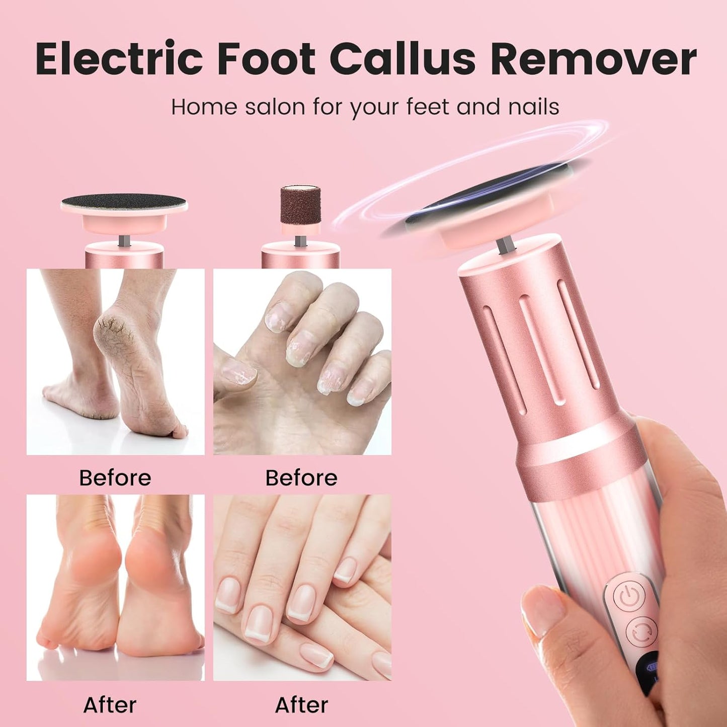 2 in 1 Electric Foot Callus Remover, 2000RPM Professional Electric Callus Remover for Feet with 6 Adjustable Settings, Rechargeable Foot File & Nail Drill with 40Pcs Sandpaper Discs (Pink)