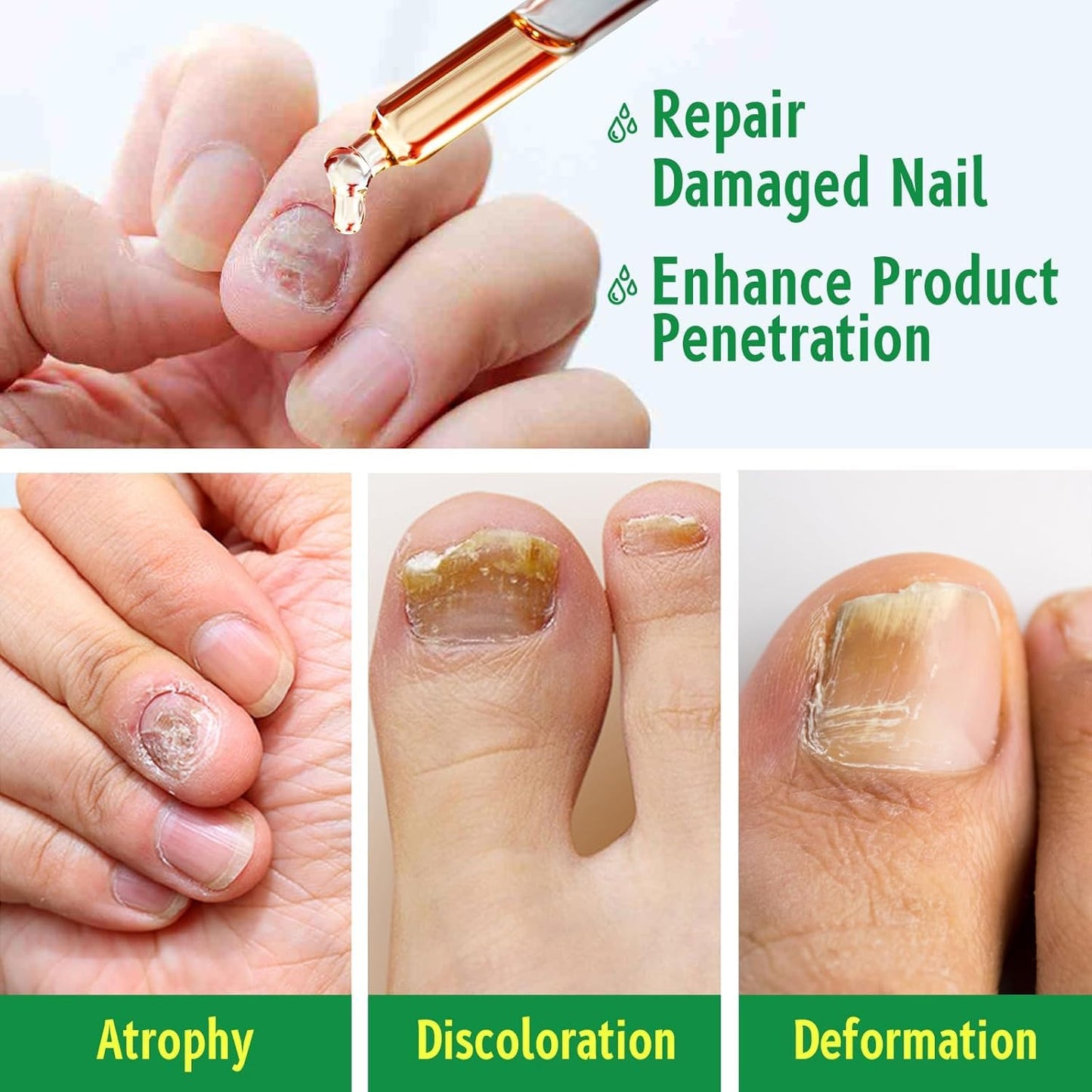 Ginger Nail Treatments, 7 Days Ginger Cuticle Care Oil for Nails for Strengthen nails & Promote Nail Growth, Natural Plant Formula（2PCS)