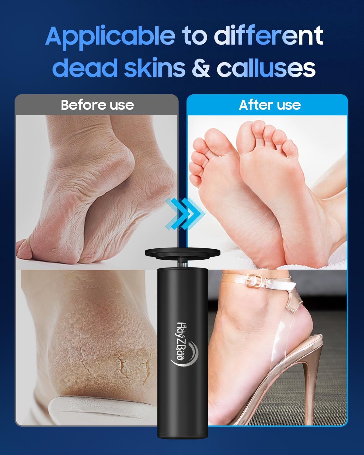 Electric Foot File - Electric Callus Remover for Feet,Adjustable Speed Foot Scrubber with 60 Pcs Sandpaper Discs,Professional Pedicure Tool for Dead Skin and Calluses - Black