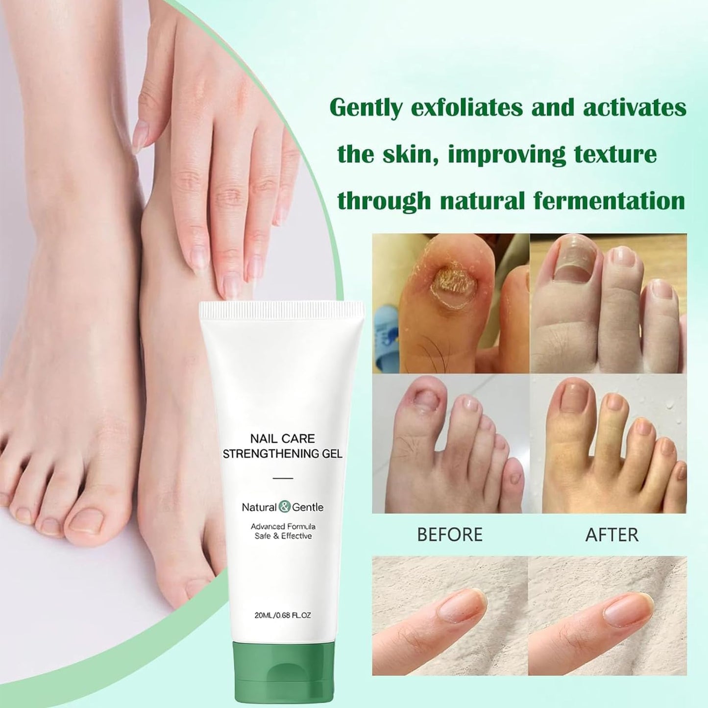 Natural Nail Care Gel, Nutraboost Strengthening Cuticle Serum for Damaged & Brittle Nails, 20ml (1 pcs) (3pcs)