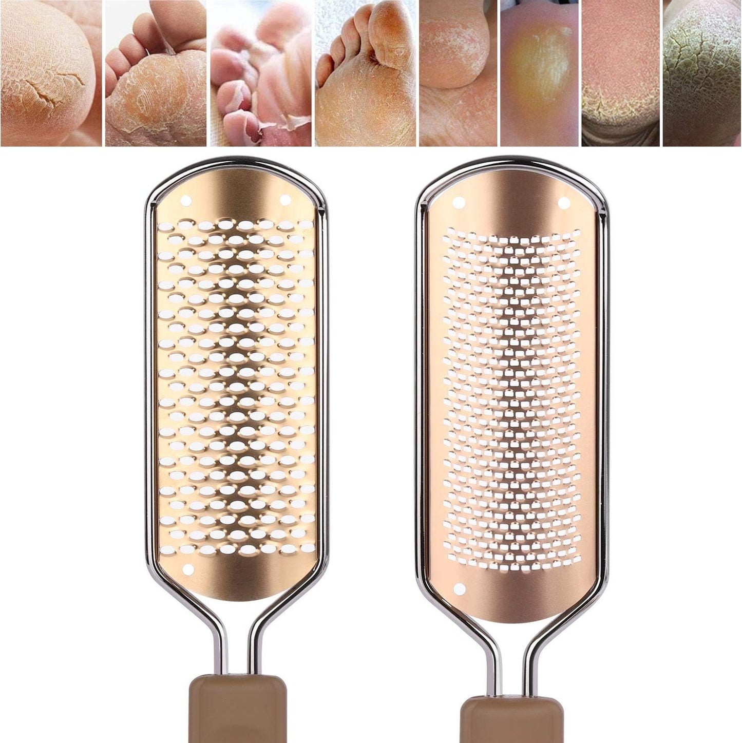 2 Pack Foot File & Rasp Callus Remover - Stainless Steel Coarse & Fine Scraper for Dry/Wet Feet, Professional Dead Skin Scrubber & Cracked Heel Care