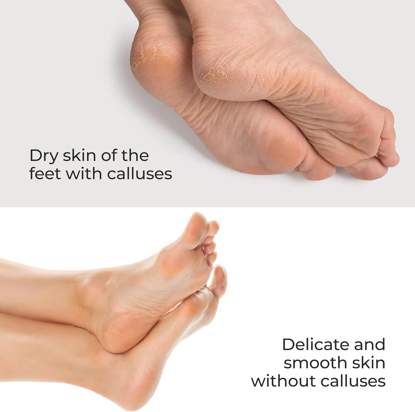 Nano Glass Foot File Callus Remover Professional Pedicure Tool for Feet, Heel Scraper for Cracked Heels, Foot Scrubber for Dead Skin with Pedicure Kit