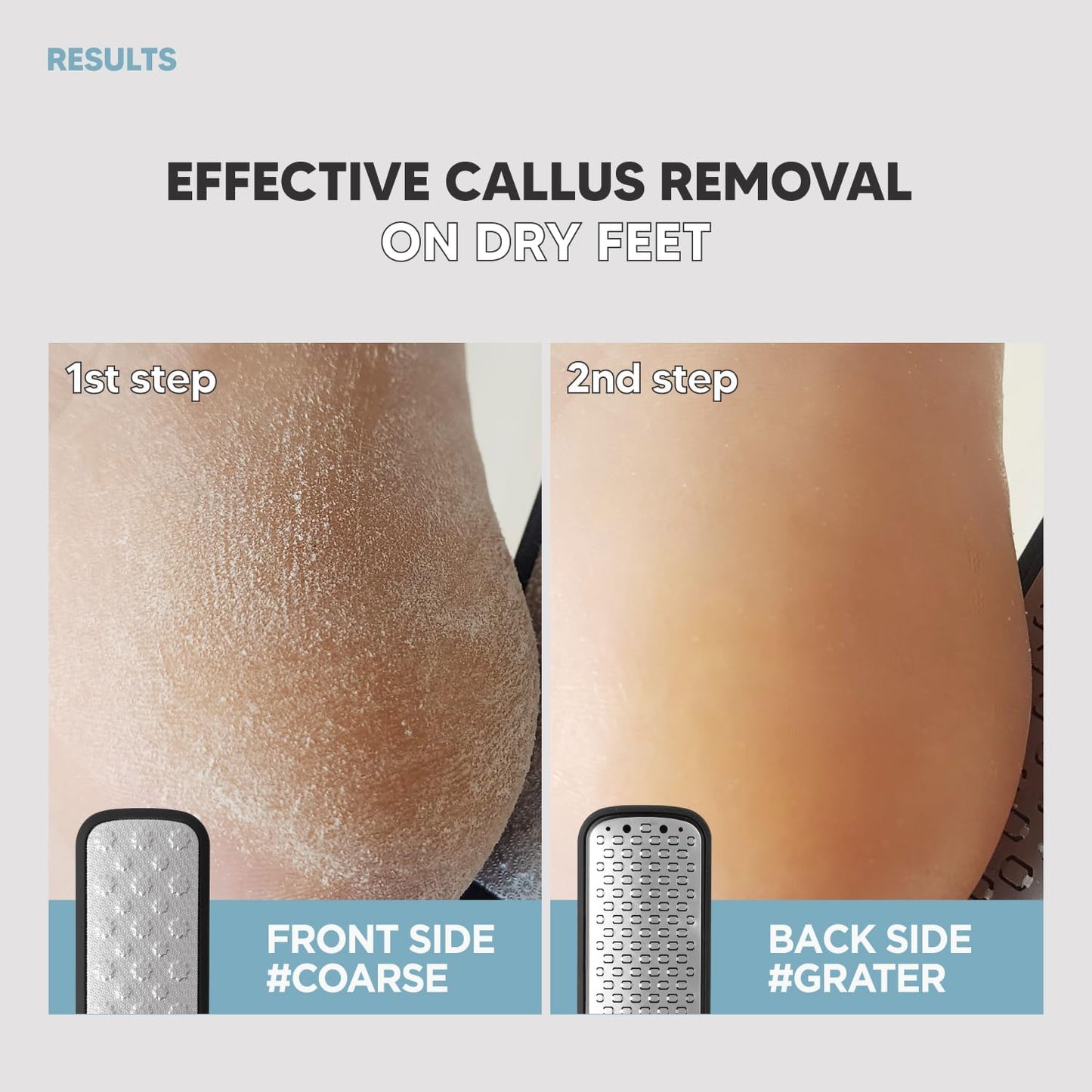 2Steps Stainless Steel Callus Remover, Effective for Thick Callus and Cracked Feet Pedicure Rasp, Remove Hard Skin, Grater Foot File, Foot Scrubber, Professional Foot Care