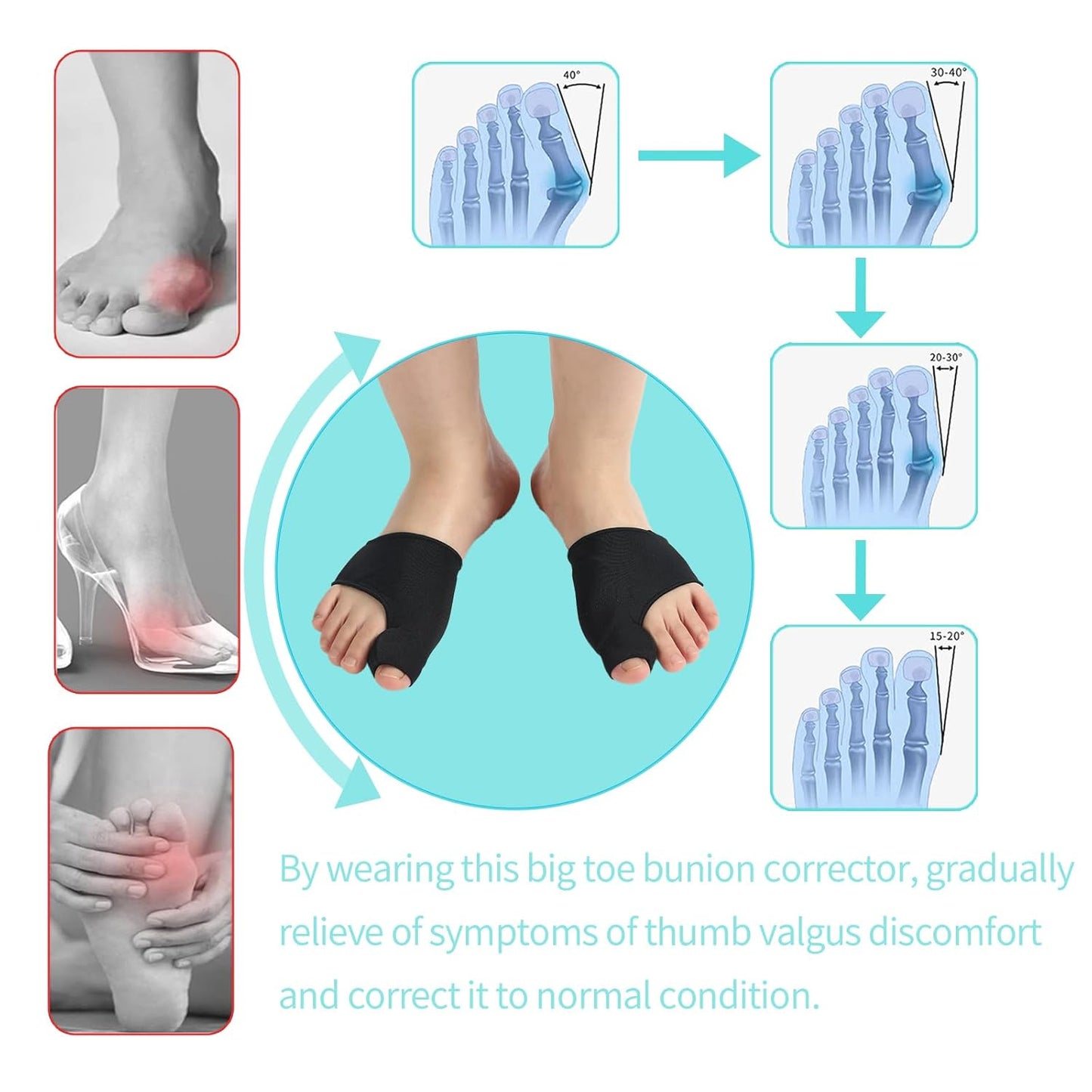 Bunion Relief Sleeve For Men Women And Kids，Bunion Corrector Sleeve Socks For Hallux Valgus，Big Toe Separators and Pinky Separators Pack （Black, Small
