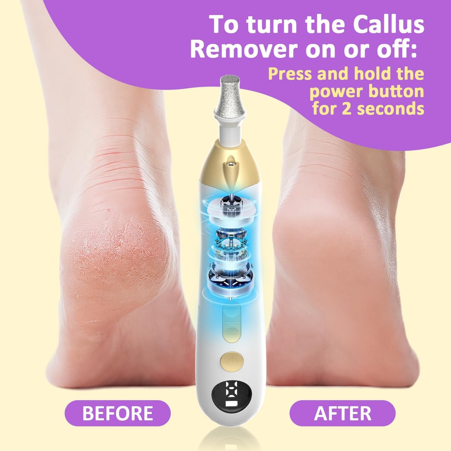 Callus Remover for Feet, Electric Foot Callus Remover - 8 Grinding Heads, 9 Speeds, Rechargeable Foot File - Professional Pedicure Tool for Hard Skin, Calluses & Cracked Feet Pink