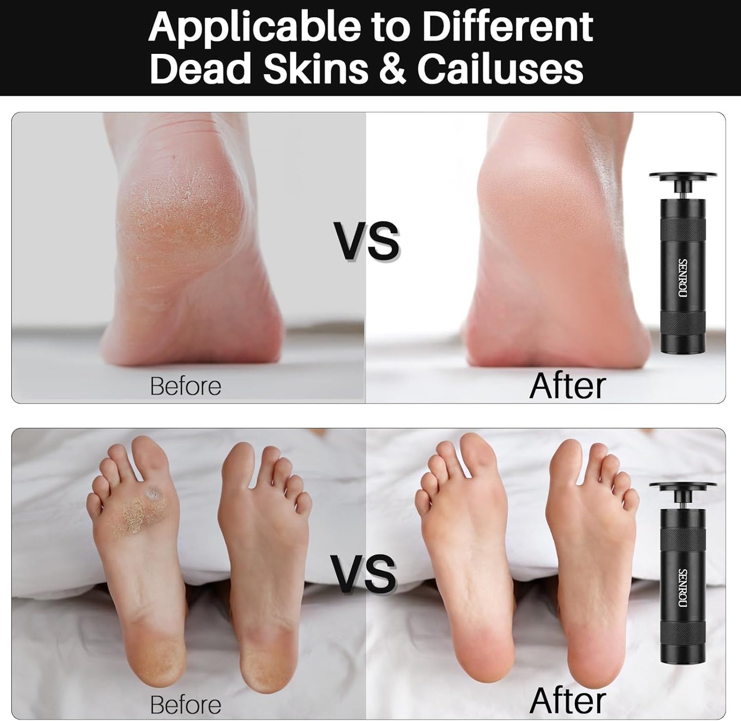 Electric Foot Callus Remover, 2-in-1 Electric Foot Filer/Nail Filer, Callus Remover for Feet with 60Pcs+12Pcs Sandpaper Discs，Holiday Gift Foot Repair Tool, Black