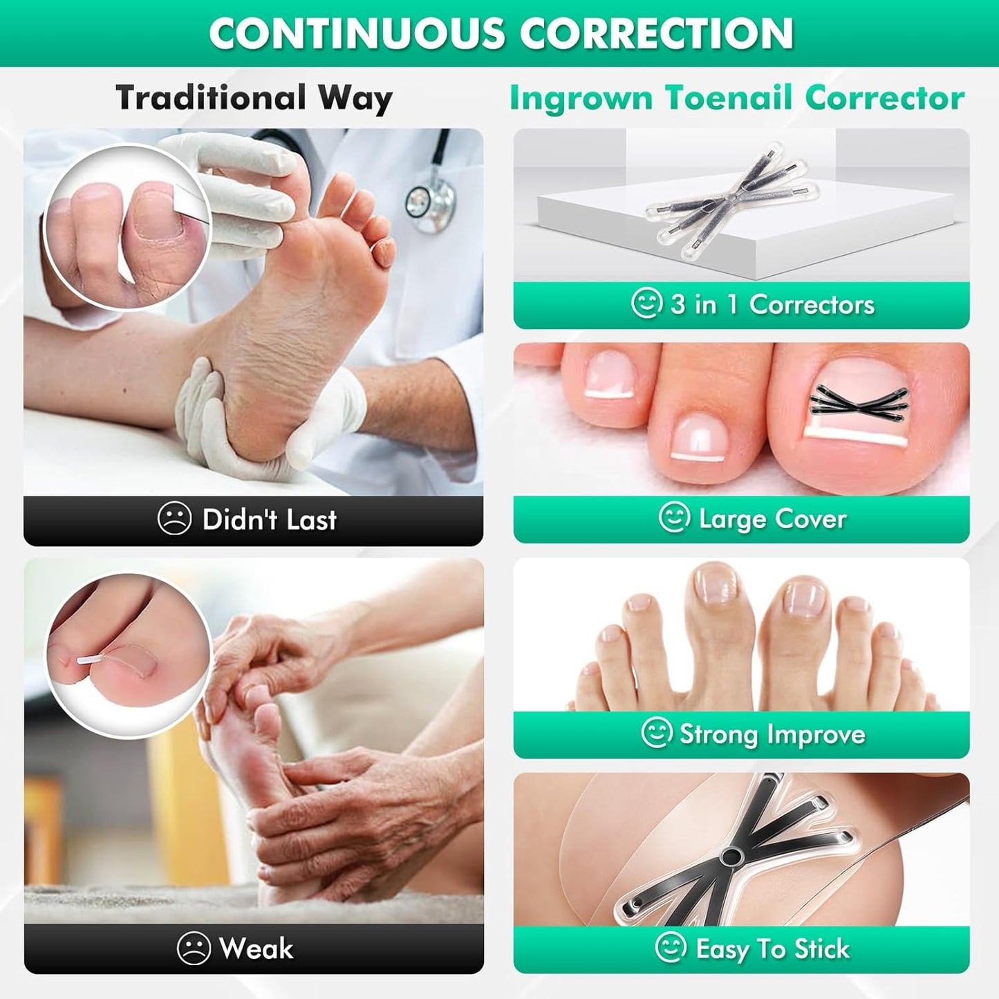 Ingrown Toenail Correctors Tripled, Quick Relief Ingrown Toenail Treatment Removal Tool Kit at Home, Curve Correct for Big Toe Ingrown Nail Outgrow Lifter Sticks To The Nail 0.59/0.66in