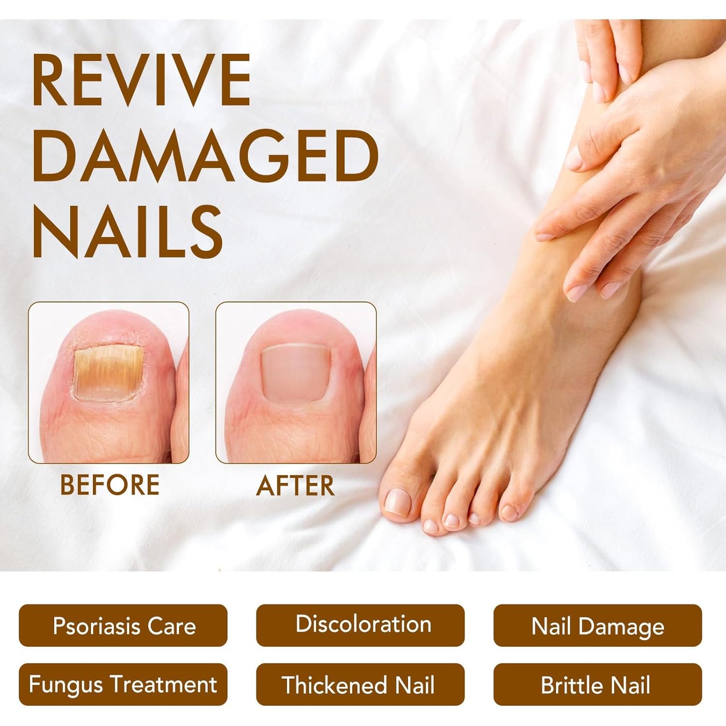 Ginger Nail Strengthener Serum 2pack– Ginger-Infused Nail Repair Oil for Care, Natural Nail and Strengthener Solution