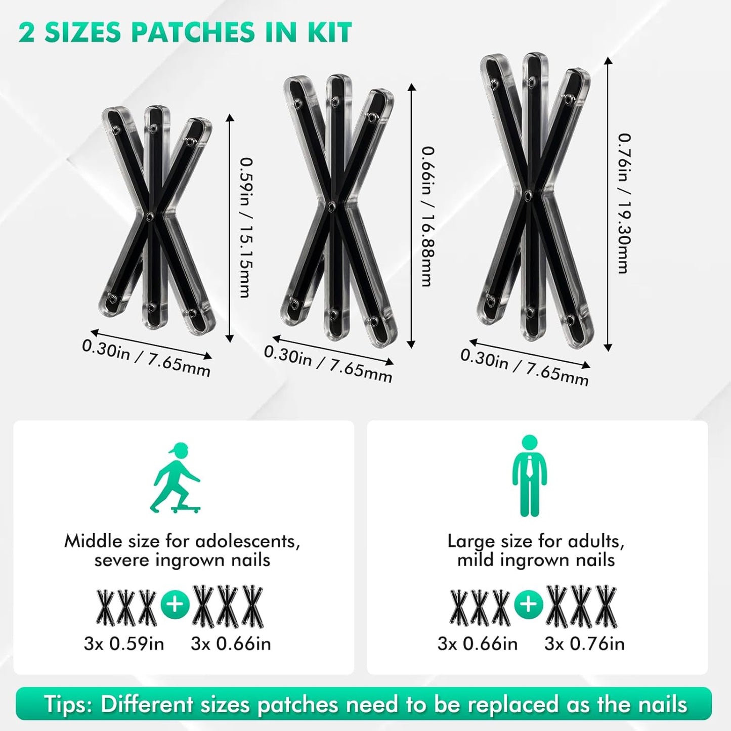 Ingrown Toenail Correctors Tripled, Quick Relief Ingrown Toenail Treatment Removal Tool Kit at Home, Curve Correct for Big Toe Ingrown Nail Outgrow Lifter Sticks To The Nail 0.59/0.66in