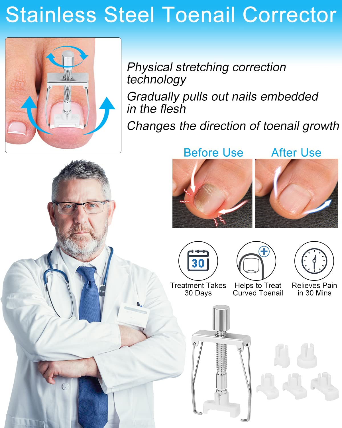 Ingrown Toenail Removal Kit, Ingrown Toenail Treatment, Ingrown Toenail Corrector Tools Come with Podiatry Toenail Braces, Ingrown Toenail Corrector Strips and Patch for Toe Pain Relief