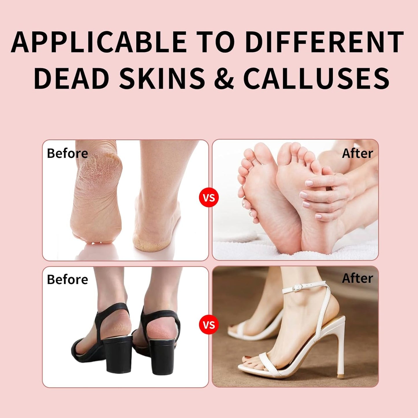 2025 Dermave Electric Foot Callus Remover for feet, ProfessionalPedicure Tool forDead Skin Removat, Best Electrie-Foot File for Women with 60 Sandpaper Discs for Soft Smooth feet