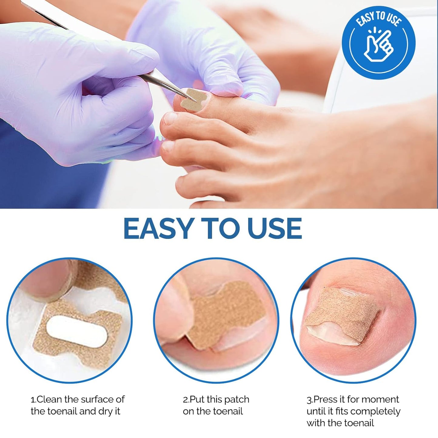 Ingrown Toenail Treatment, 50Pcs Ingrown Toenail Removal Kit with File and Lifter, Professional and Fast Acting