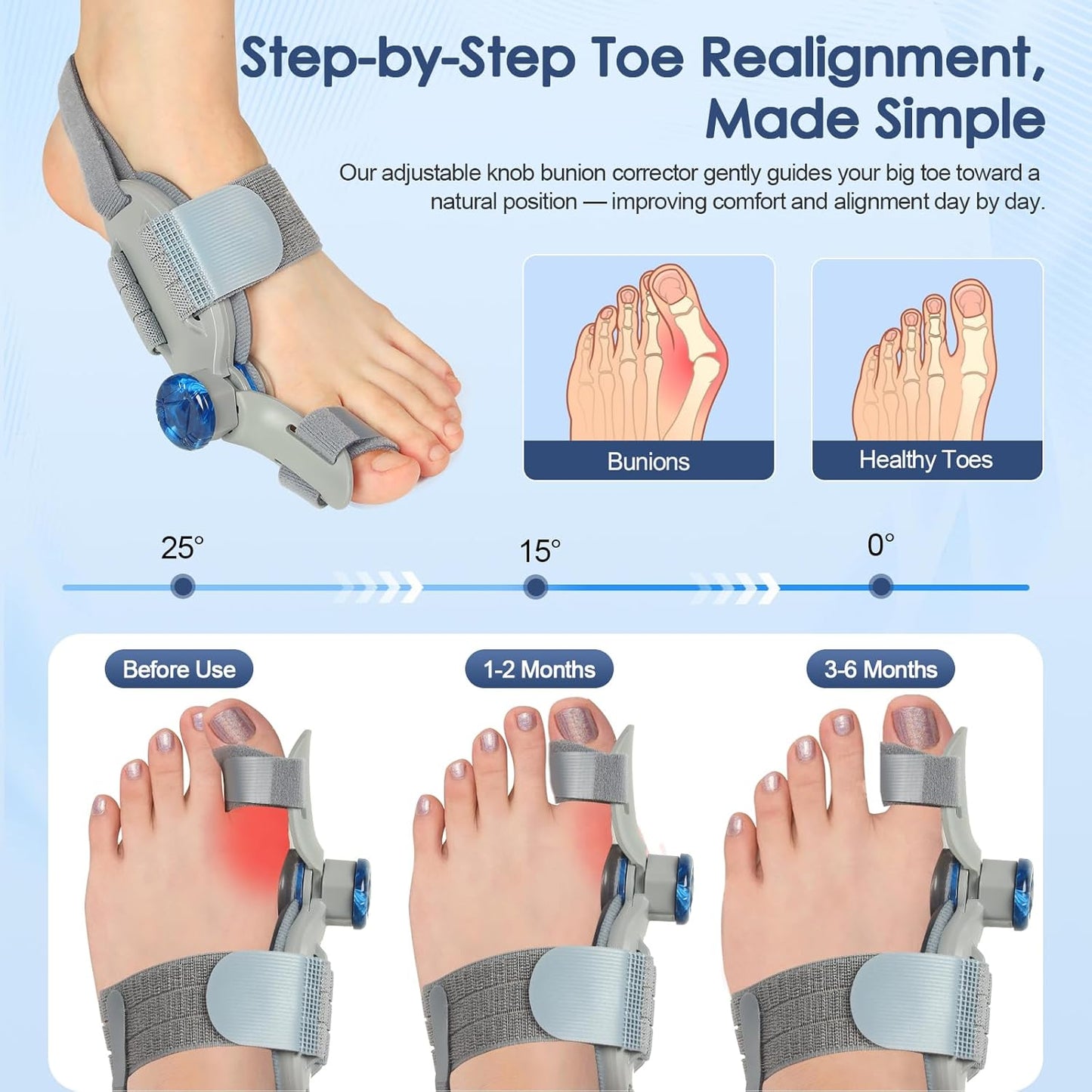 Bunion Corrector for Women Men Big Toe,Adjustable Knob Bunion Corrector for Bunion Relief,Bunion Fix with Bunion Silicone Pad,Suitable for Left and Right Feet(2PCS)