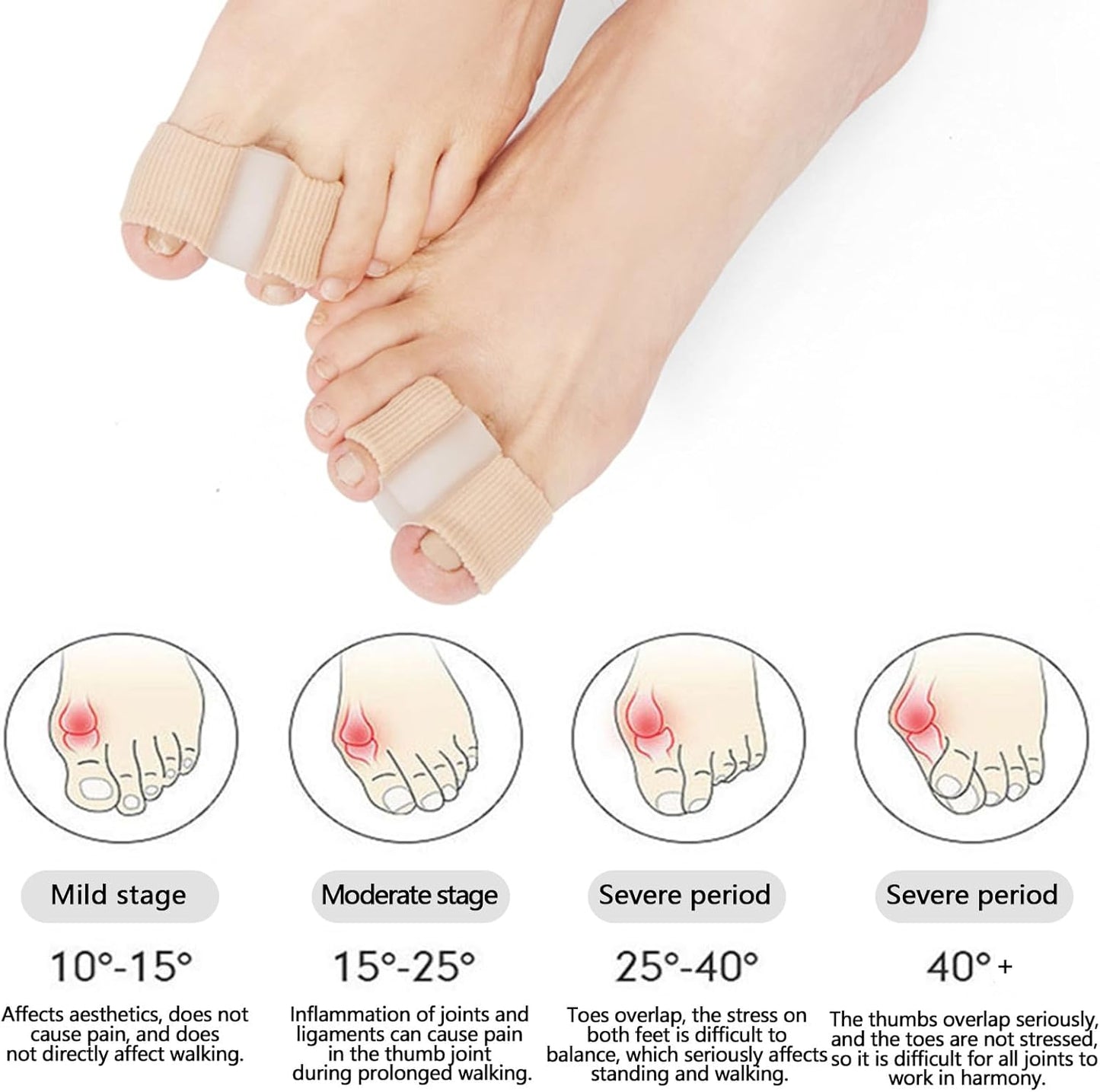 Toe Separators for Overlapping Toes, Hammer Toe Straightener, Toe Spacers Women Men, Gel Toe Separators to Correct Your Toes,Toe Separator for Bunion Pain Relief for Hallux Valgus, Foot Pain (S)