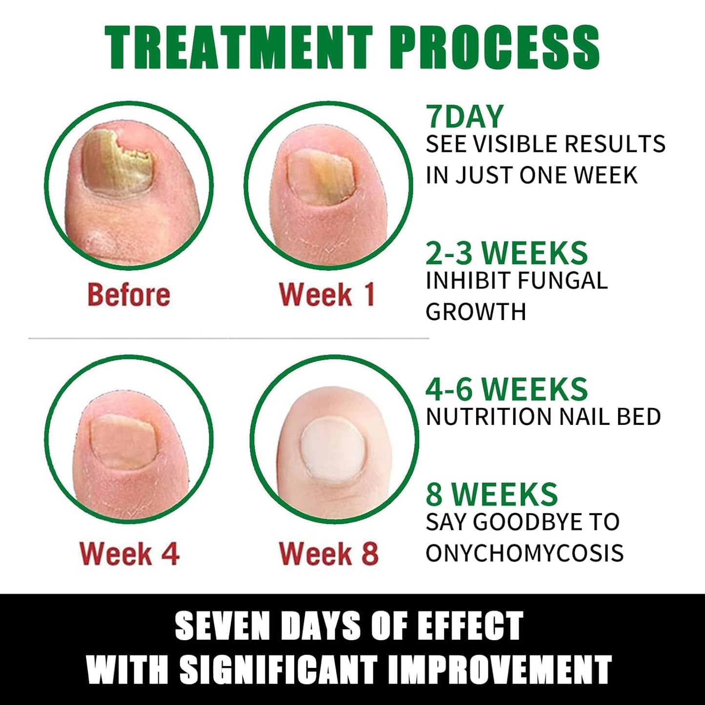 7 Day Nail Treatment, Nail Strengthener and Growth & Oregano Tea Tree Oil for Toenail: Safely and Gently, Daily Maintenance