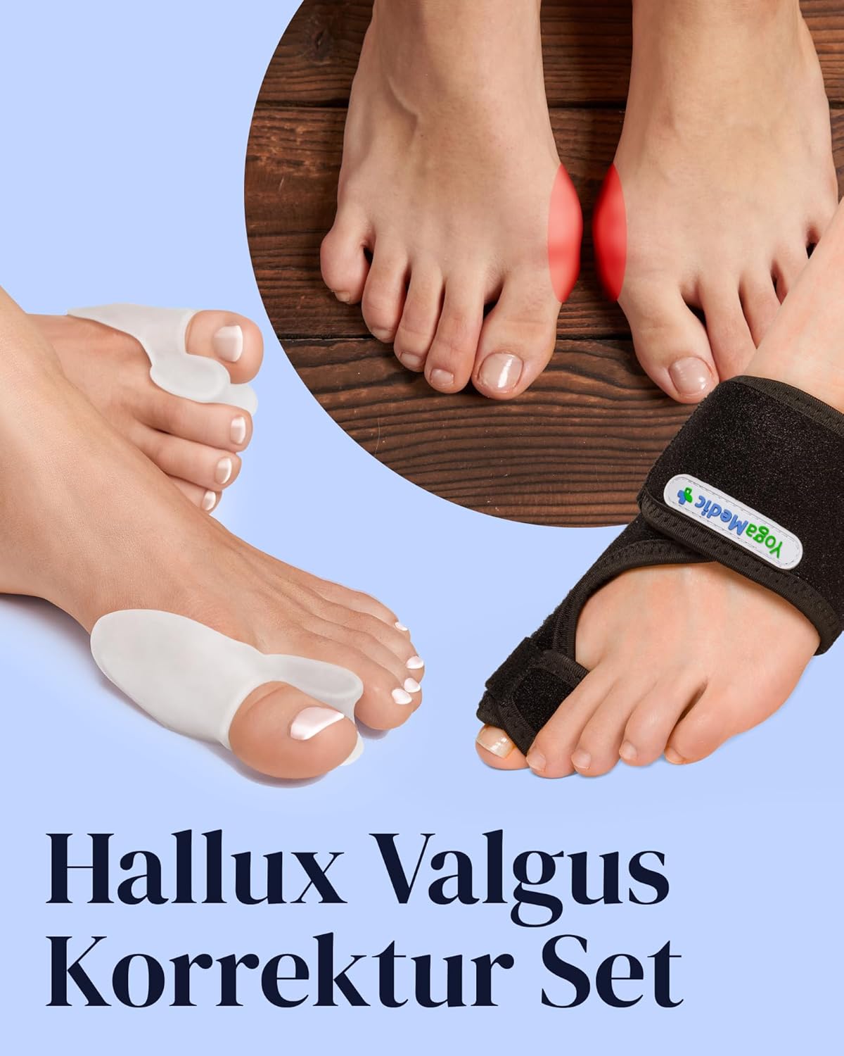 YOGAMEDIC Bunion Corrector for Women - 2 Splints & 2 Silicone Spacers - Adjustable Day & Night Wear - Toe Separators for Men for Bunion Relief