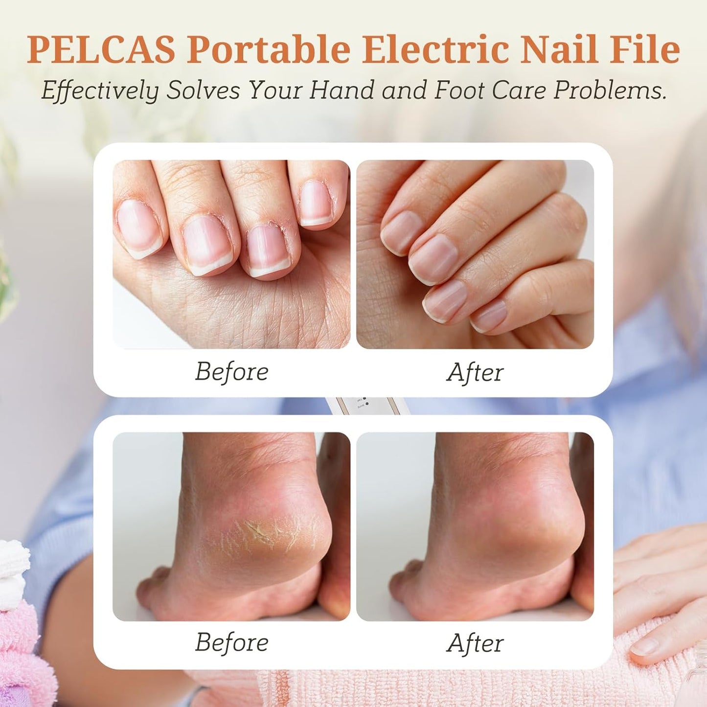 PELCAS Electric Toenail Grinder for Thick Toenails, 5 Speeds Manicure and Pedicure Kit, Cordless Nail Drill with LED Light, Electric Nail File for Human, Pet, Thick Toenails, Natural & Acrylic Nails