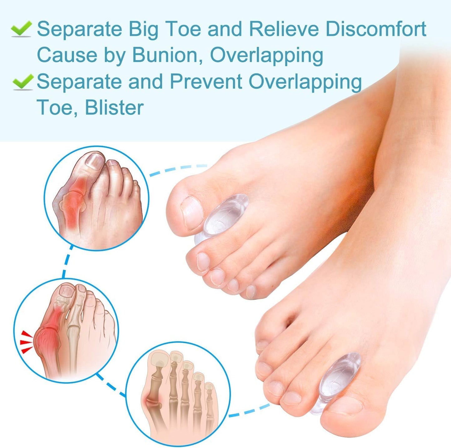Povihome 8 Pack Gel Bunion Corrector and Toe Spacers Separators and Straightener Orthotics (4/10''Thick) for Sports Activities, for Men and Women Overlapping Toes, Bunion Pain Relief - Small Size