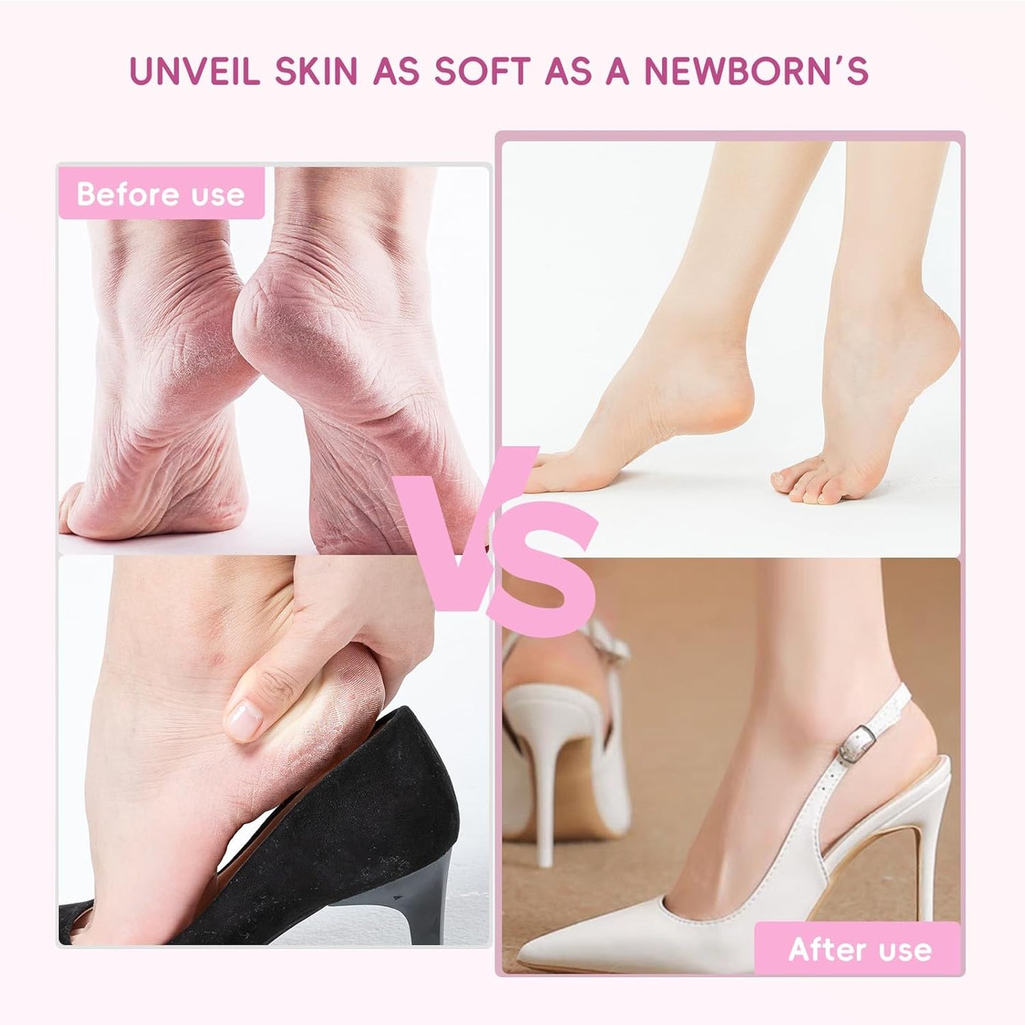 Upgrade Electric Callus Remover for Feet - Wireless Electric Foot Filer with 9 Speed Settings, Type-C Charging, Pedicure Tools for Dead Skin-Pink