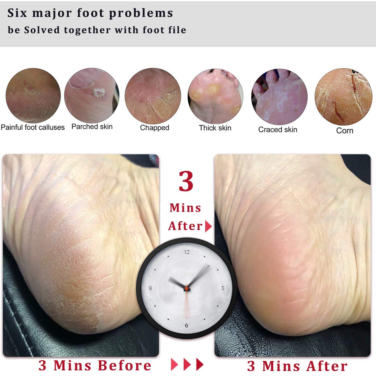 Foot File Callus Remover Foot Scrubber,Professional Pedicure Foot Rasp Removes Cracked Heels,Dead Skin,Corn,Hard Skin,Pumice Stone for Scraper File Brush Tools for Wet and Dry Feet