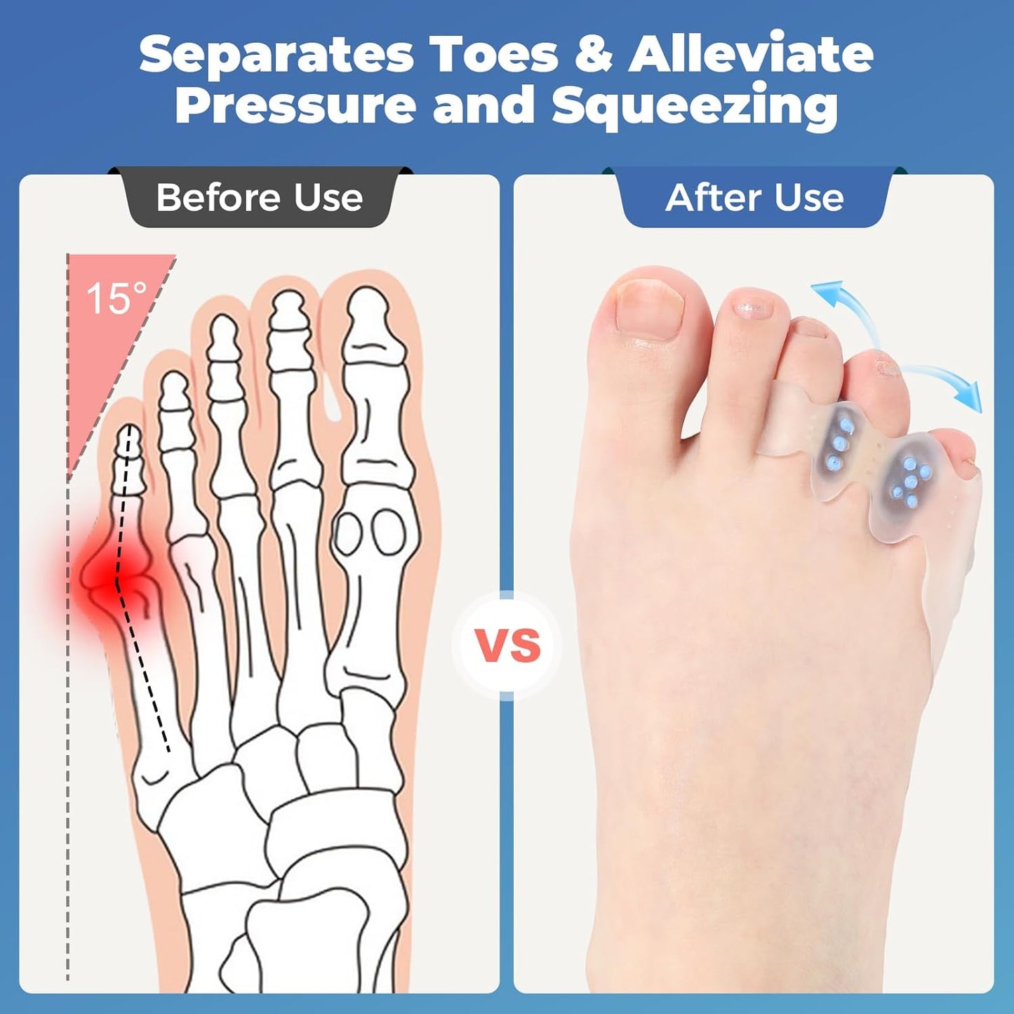 Tailor's Bunion Corrector and Pinky Toe Spacers Kit for Curled Toes and Pain Relief - Tailor Separators, Pinky Toe Protectors, and Morton's Neuroma Relief (1 Pair)