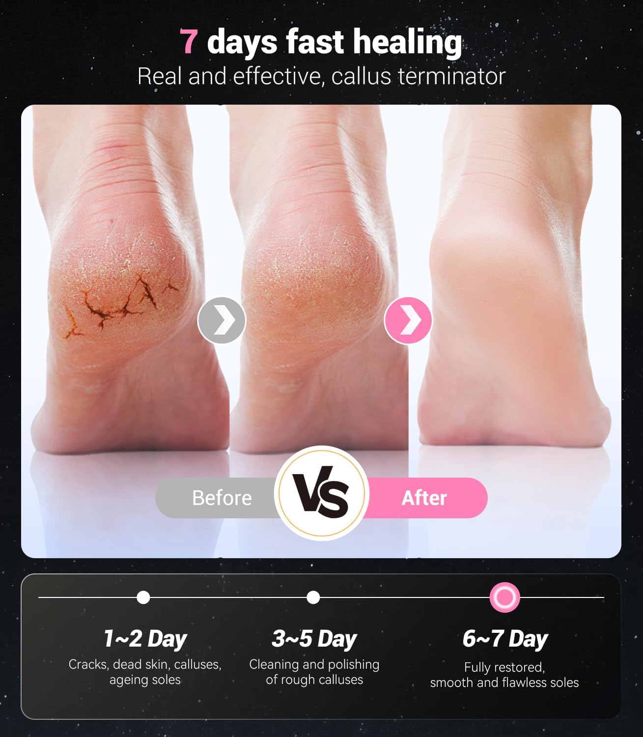 5-in-1 Professional Electric Foot Callus Remover(Portable & Foldable), Removes 99.92% of Calluses in 3 Mins, Rechargeable Foot File Pedicure Kits with 10 & 40 Grit Pads for Smooth Feet, Pink