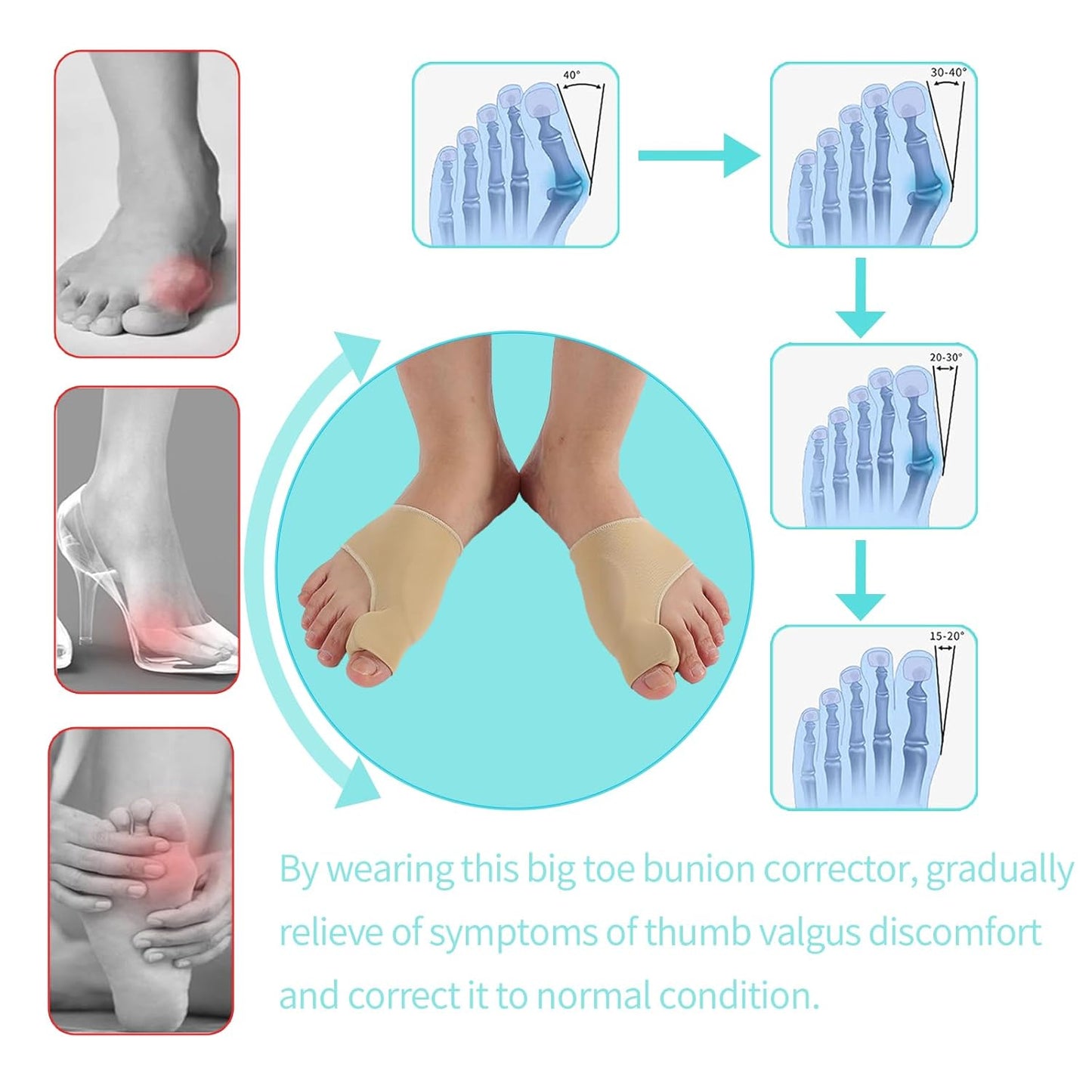 Bunion Corrector Sleeve Socks with Big Toe Separators and Pinky Separators Pack for Men and Women Non-Slip Big Toe Straightener Big Toe Alignment Bunion Toe Relief Pain (Khaki, Small)