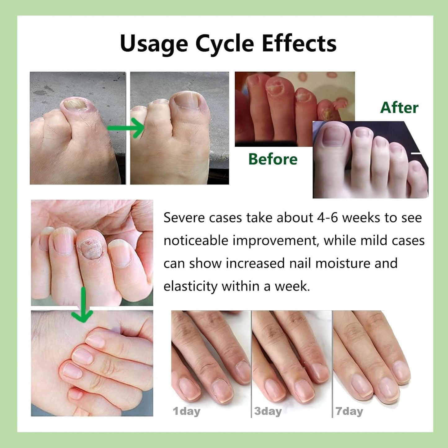 Natural Nail Care Gel, Nutraboost Strengthening Cuticle Serum for Damaged & Brittle Nails, 20ml (1 pcs) (3pcs)