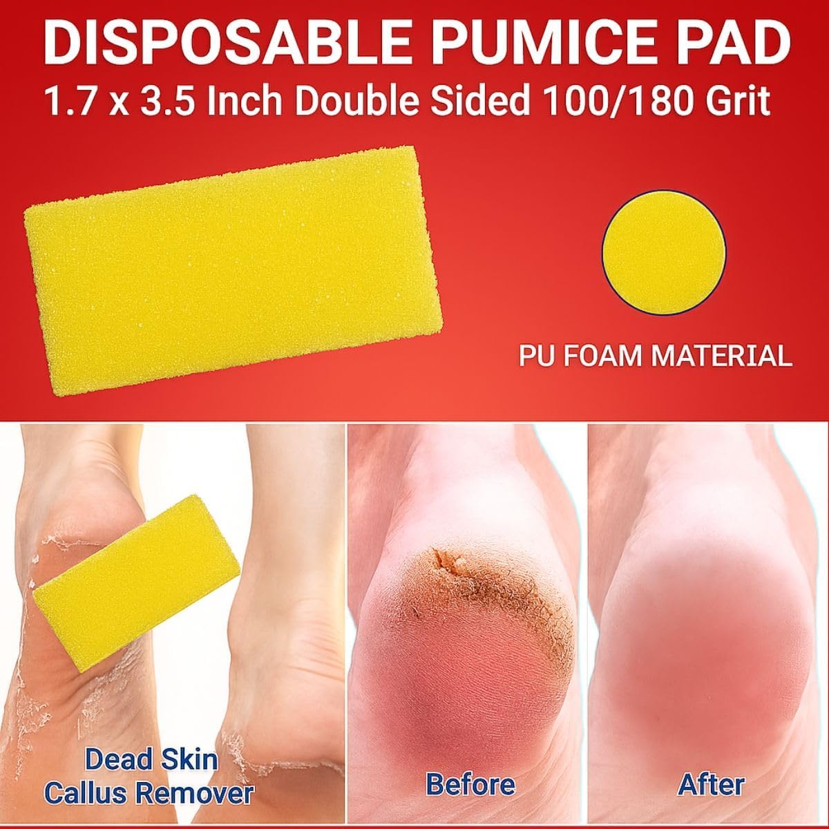 Disposable Pedicure Kit, 200 Sets – 4-Piece Individually Wrapped Nail Care Set with Yellow Pumice, White 80/100 Grit Nail File, Orange Buffer, Toe Separators – Spa & Salon Use