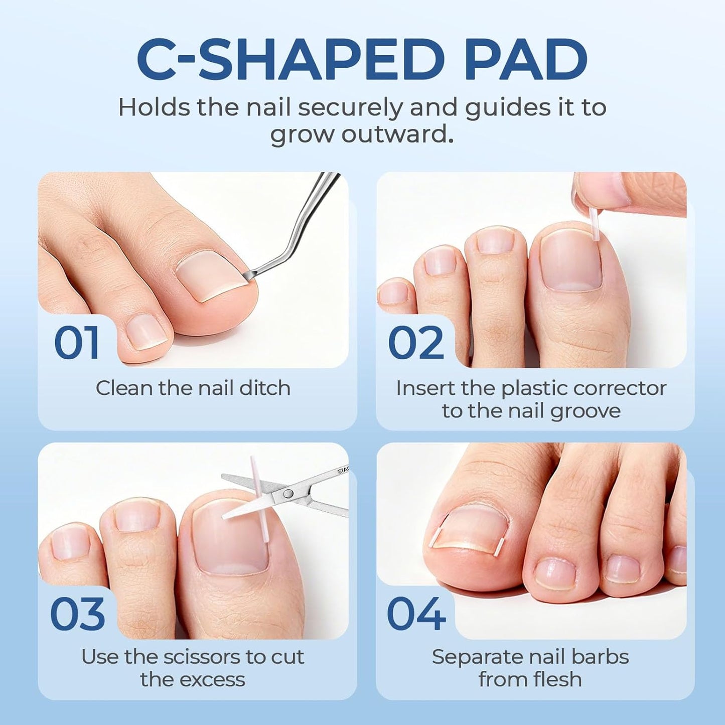 Ingrown Toenail Corrector Set with Correction Strips, Professional Ingrown Toenail Removal Kit Pedicure Tool Set, In Grown Toe Nail Remover Curve Tape at Home for Men Women