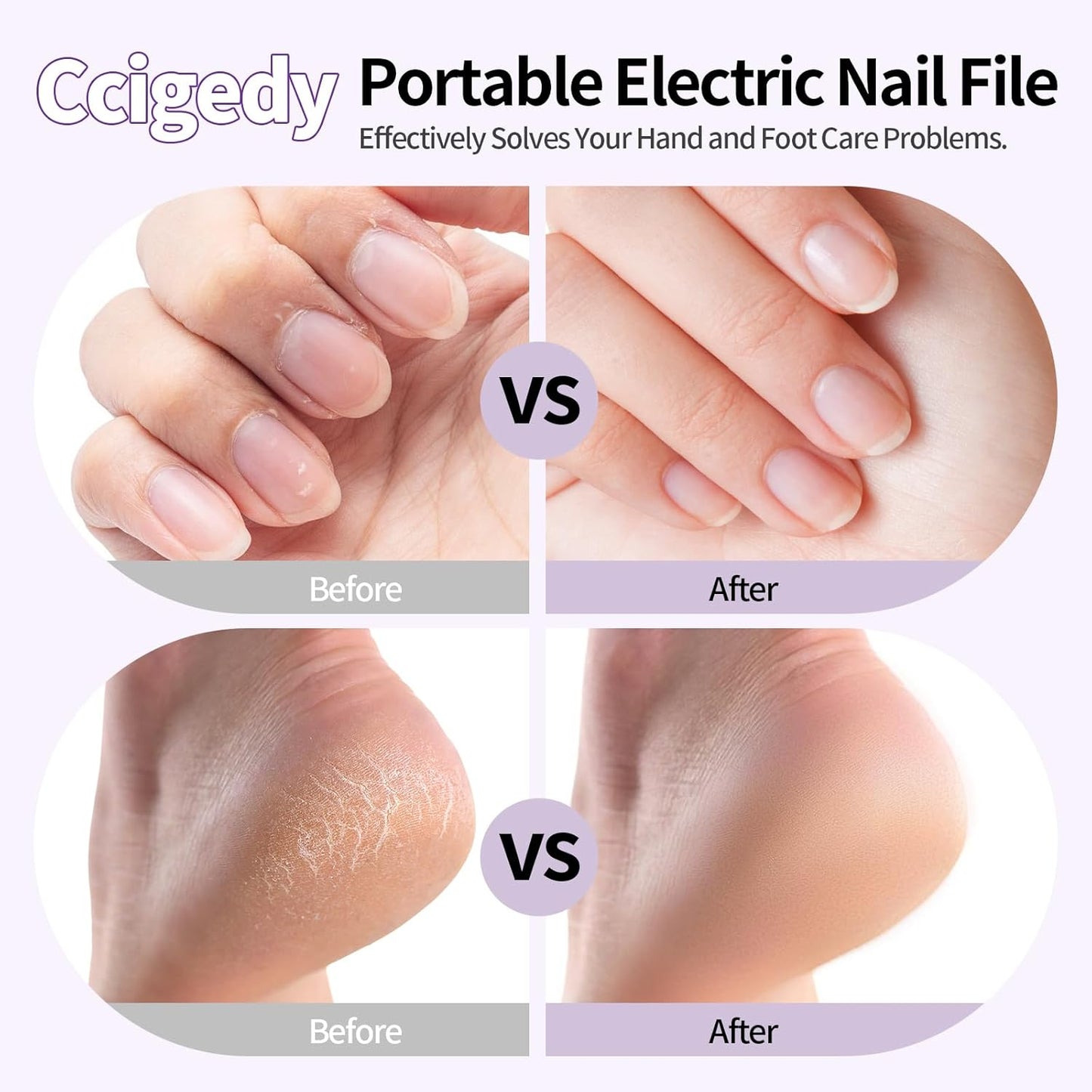 Professional Manicure Pedicure Electric Toenail Grinder Kit - Cordless Electric Nail File Set for Thick Nails Hand Feet Care ,15 Speed,Nail Drill with LED Display Ideal Gift for Men and Women-Purple