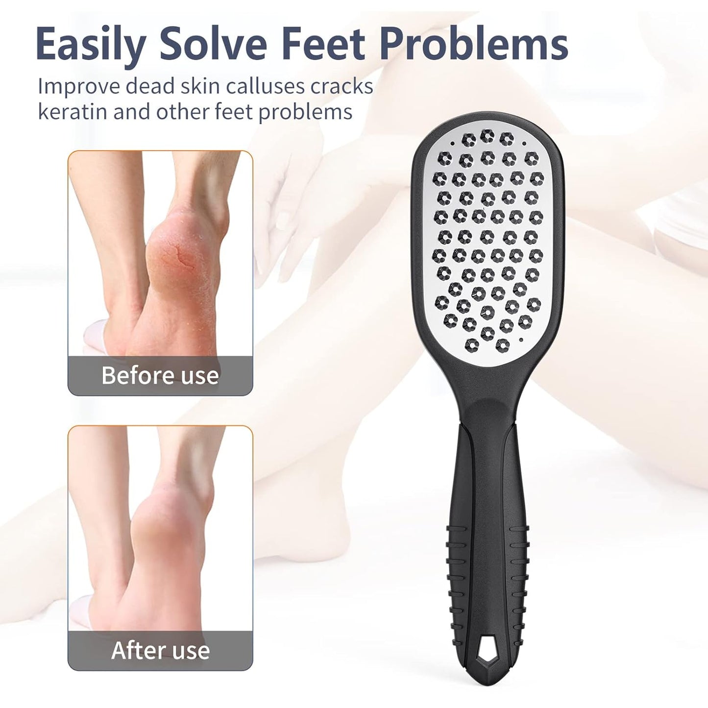 Foot Rasp Foot File and Callus Remover. Professional Foot Care Pedicure Stainless Steel File to Remove Hard Skin. Can Be Used On Both Wet and Dry Feet. -AsonTao