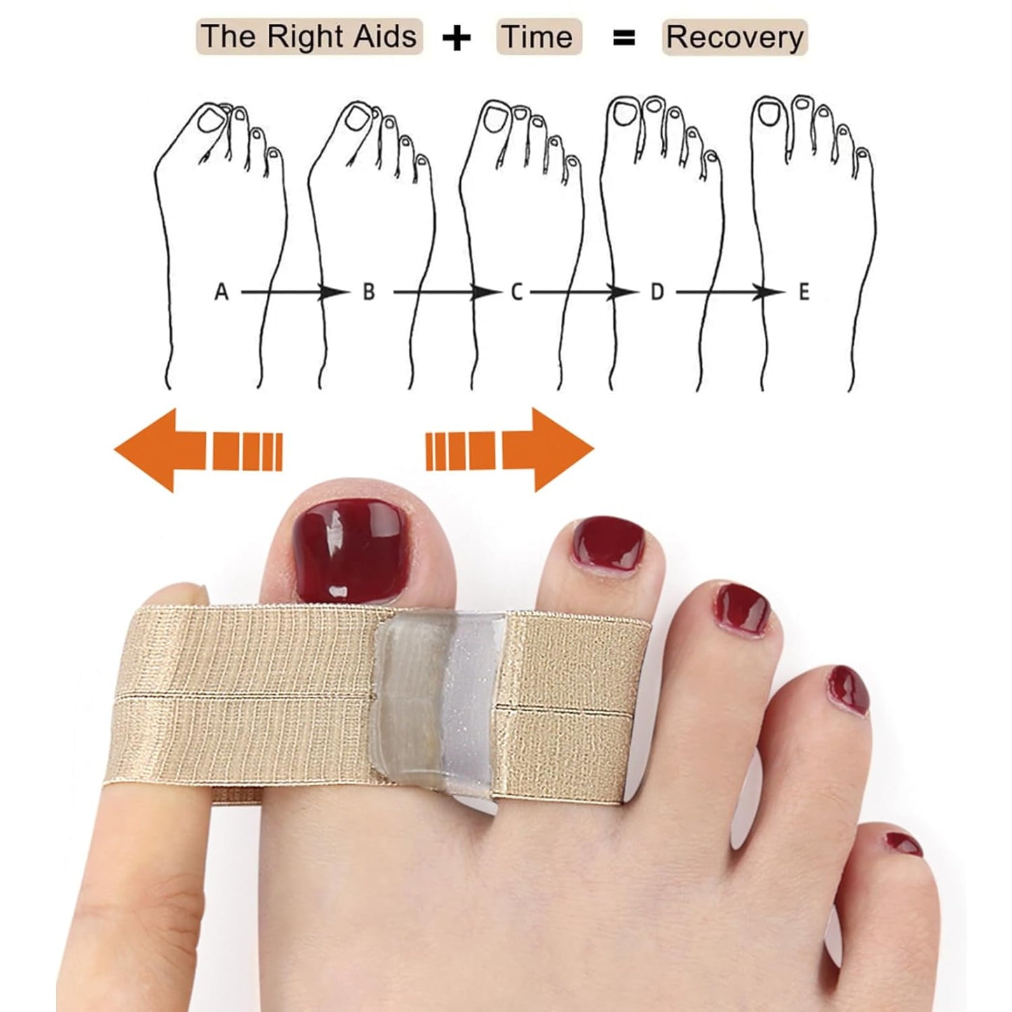 Toe Spacers for Women & Men - Bunion Corrector with Elastic Band, Silicone Toe Separators for Overlapping Toes, Correct Toes & Foot Pain Support