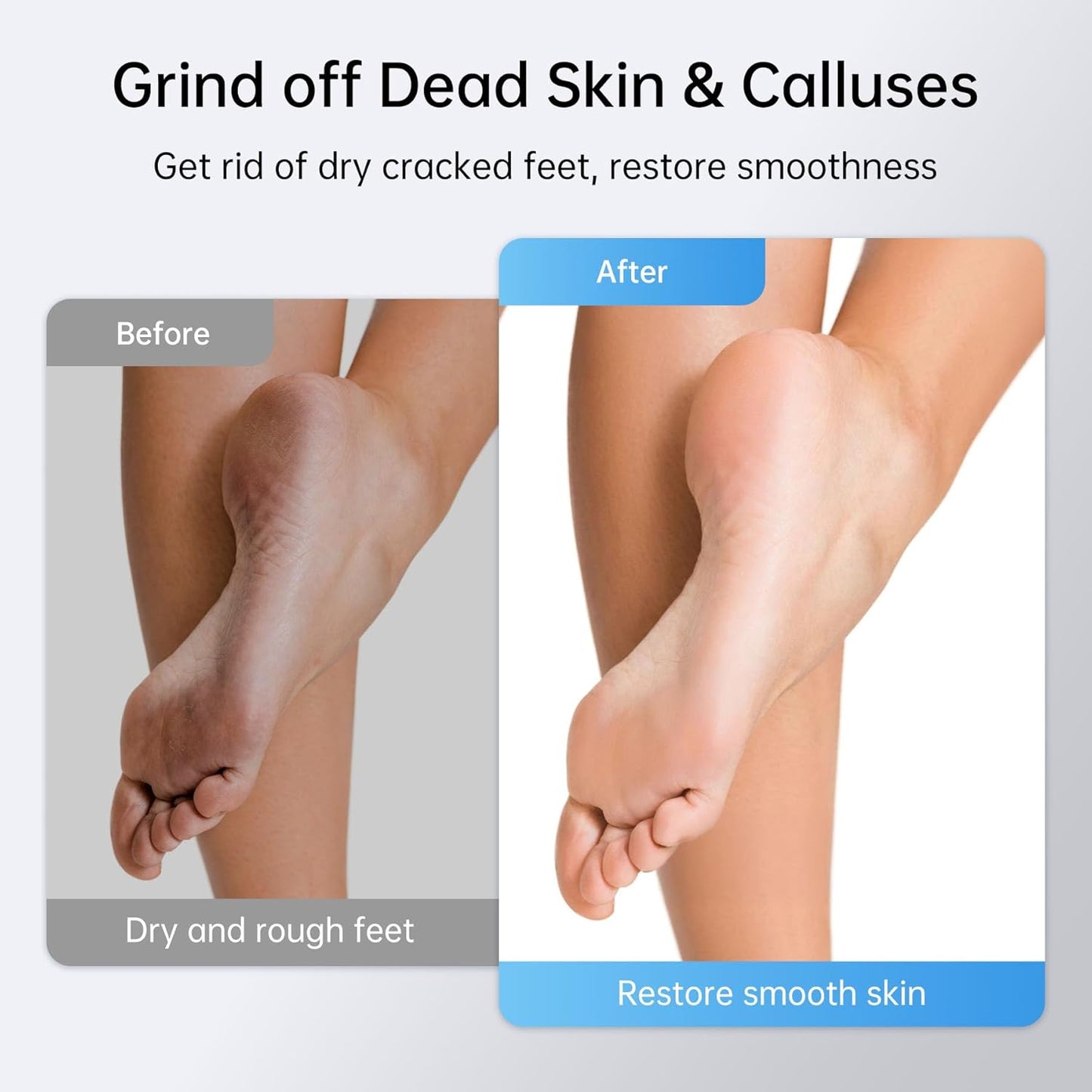 Electric Foot Callus Remover Rechargeable, 6 Speeds, Charging Base, Portable Electric Foot File Pedicure Tools for Dead Skin & Cracked Heel