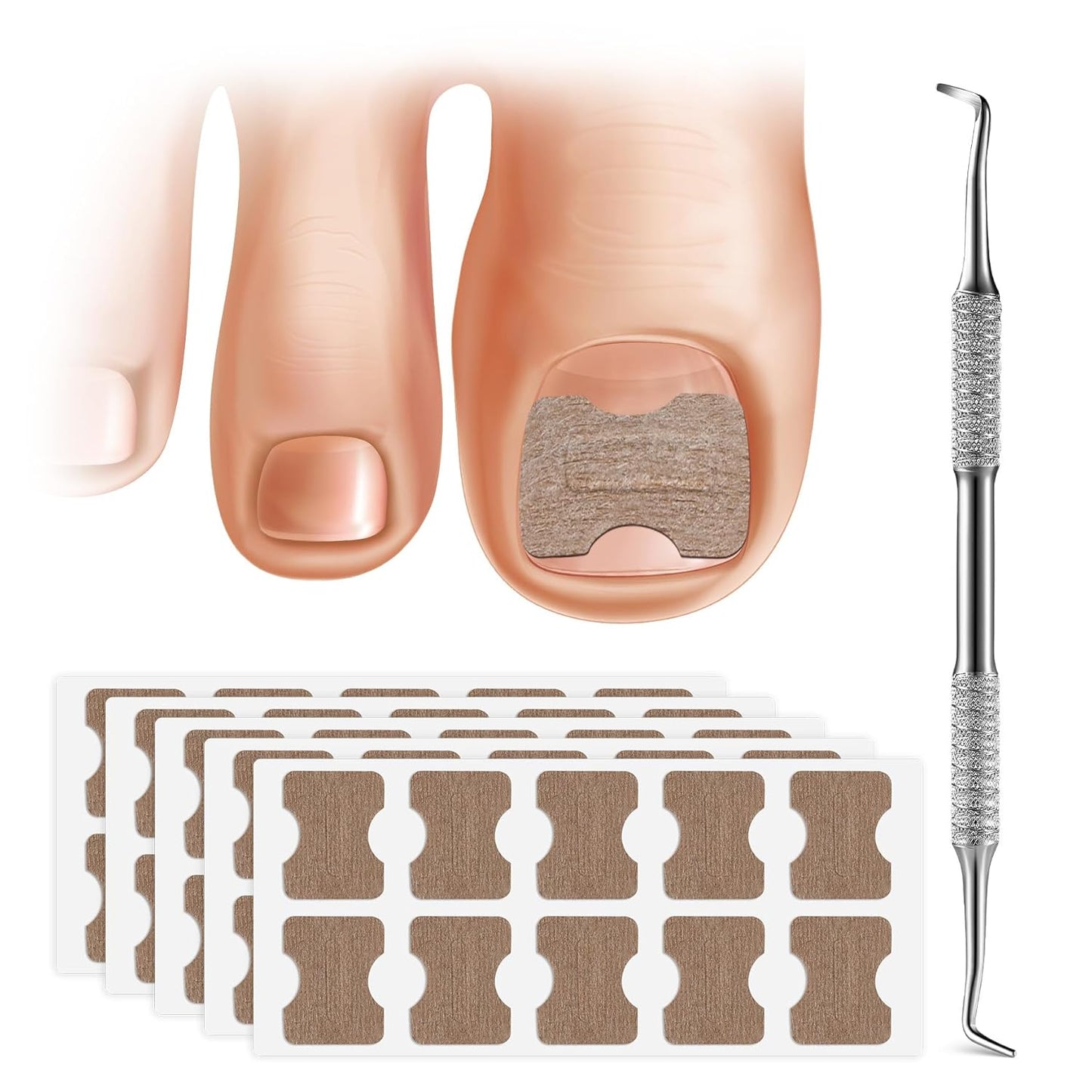 FERYES 50 PCS Breathable Ingrown Toenail Corrector Patch with Double-Ended Stainless Steel Toenail Lifter – Comprehensive Toenail Care Solution