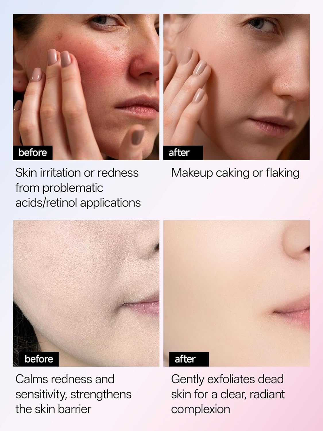 WNP 6D Bionic Collagen Bio‑Gel Mask Hydrating Overnight Real Deep with 5.1% Collagen, Niacinamide, Hyaluronic Acid, Firming, Anti‑Aging, Brightening for sensitive skin 28g x 4